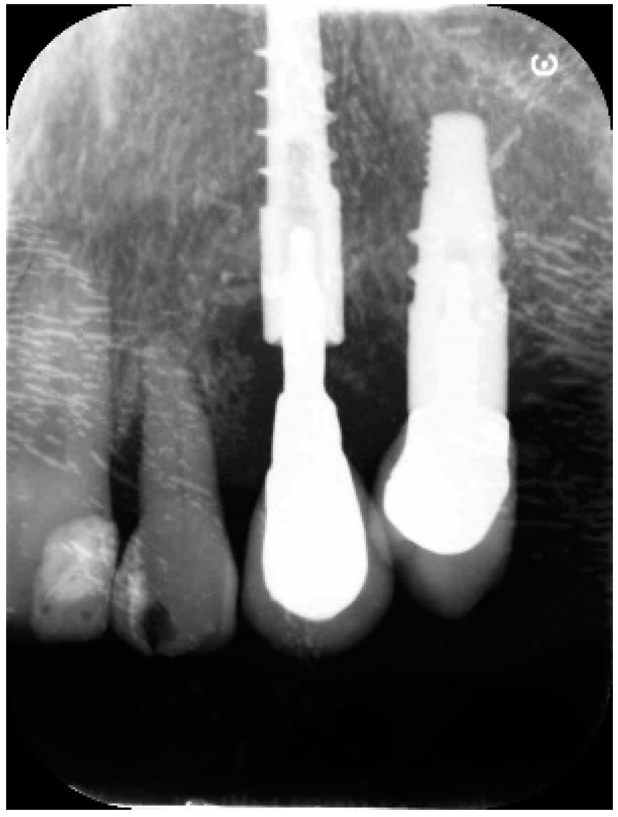 Antibiotics 10 00512 g006 Antibiotics 10 00512 g006