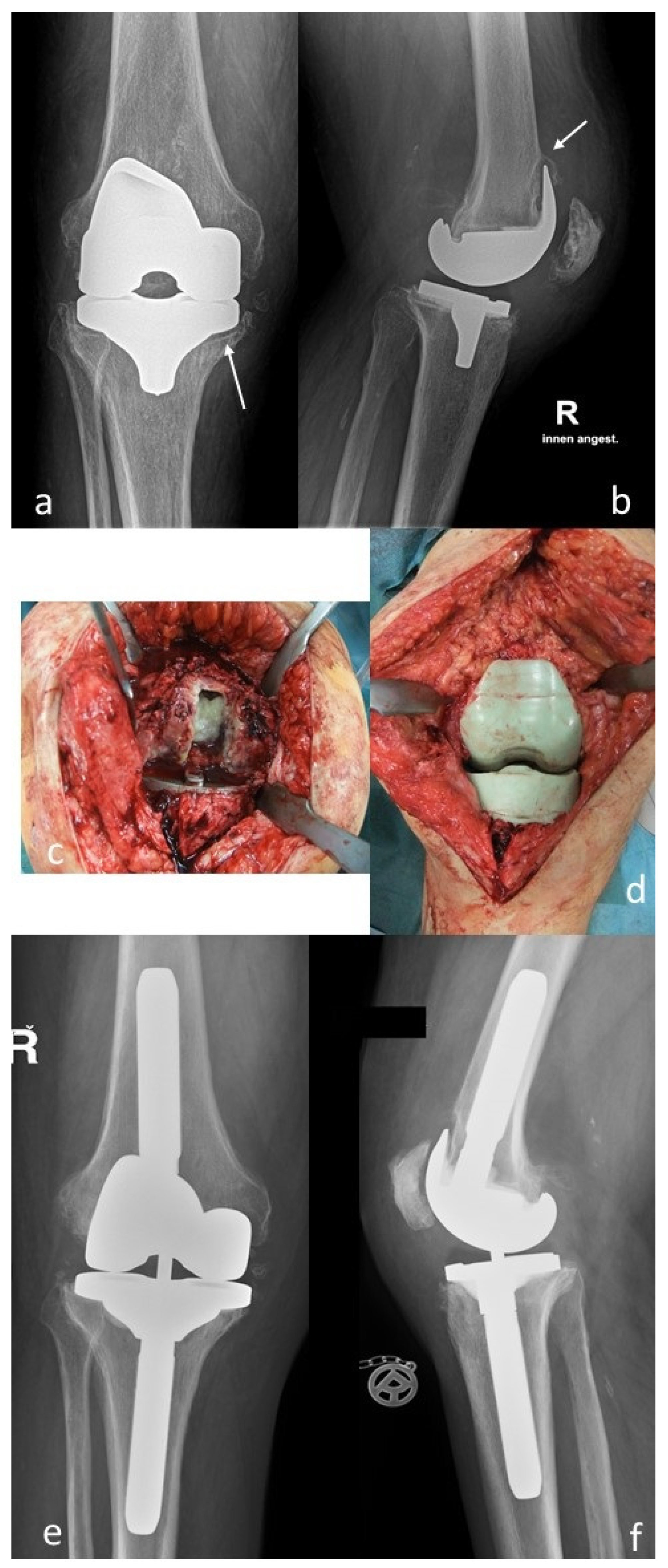 Antibiotics 10 00882 g001