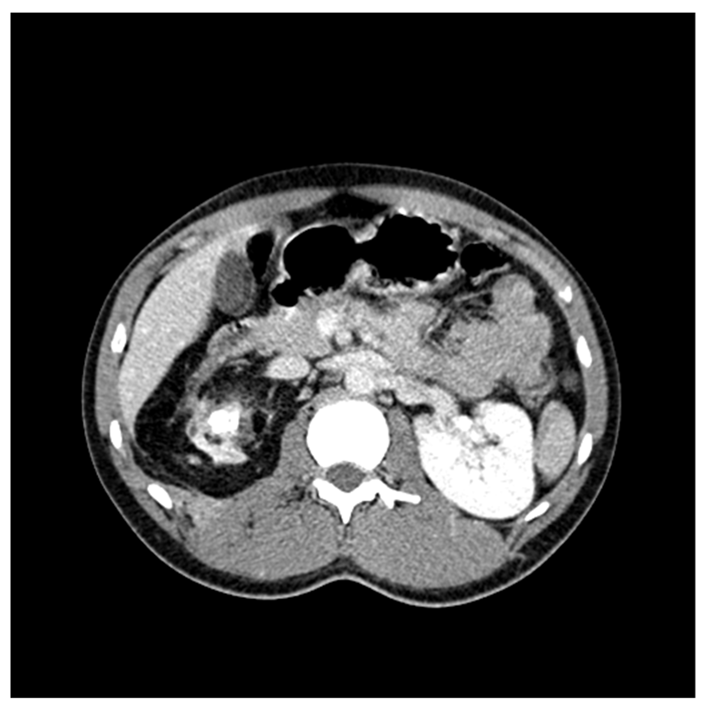 Antibiotics 10 01399 g003