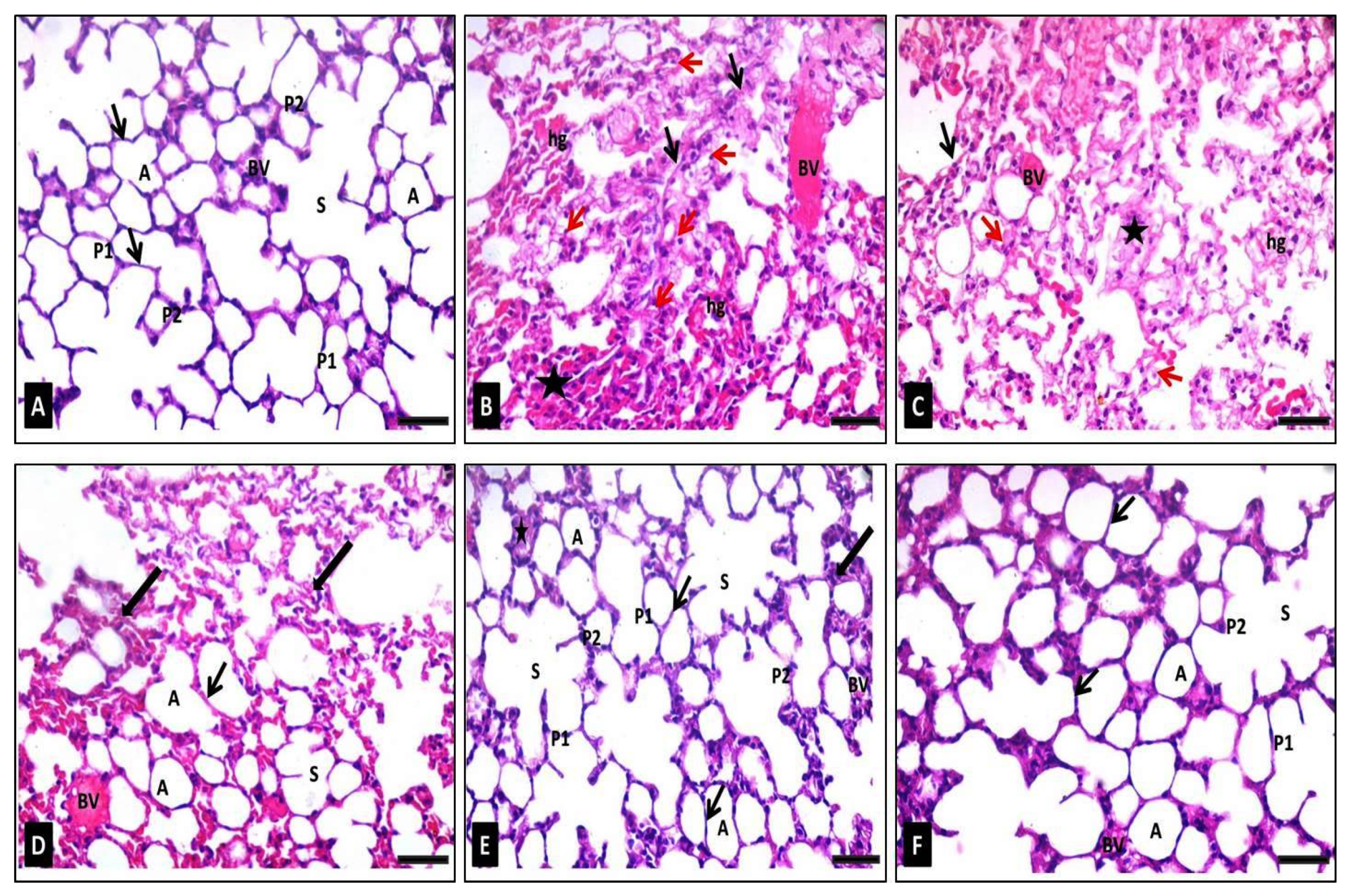 Antibiotics 10 01444 g008