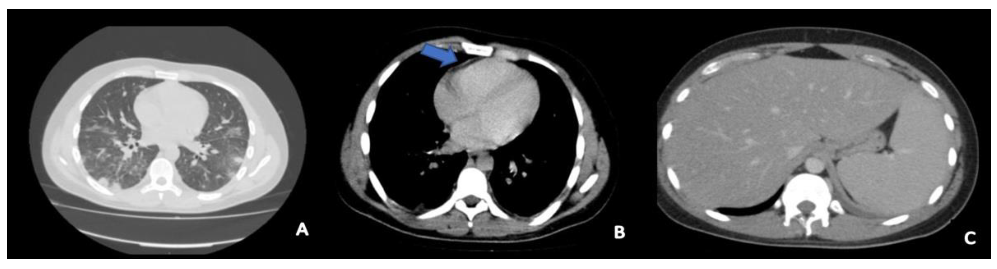 Antibiotics 10 01526 g001 550