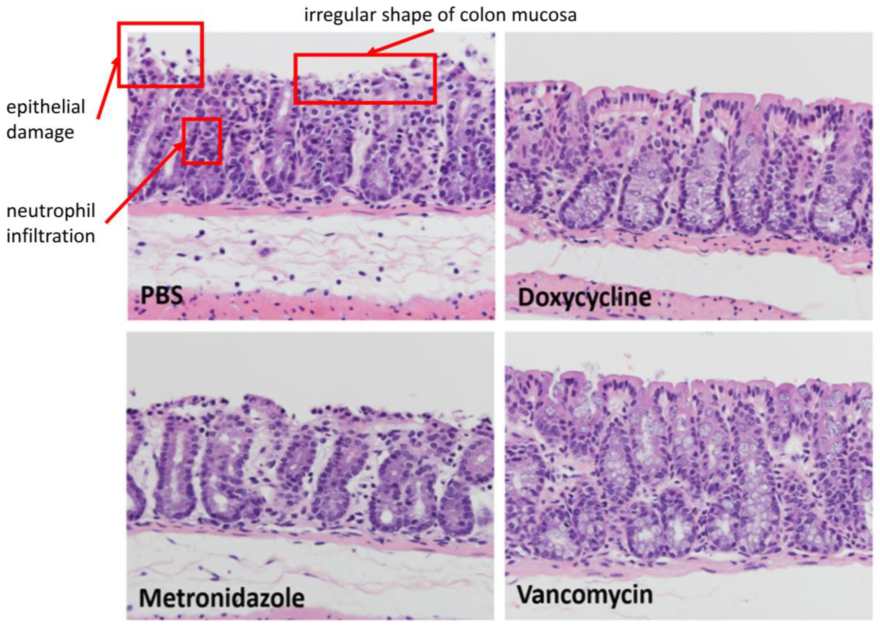 Antibiotics 11 00116 g006
