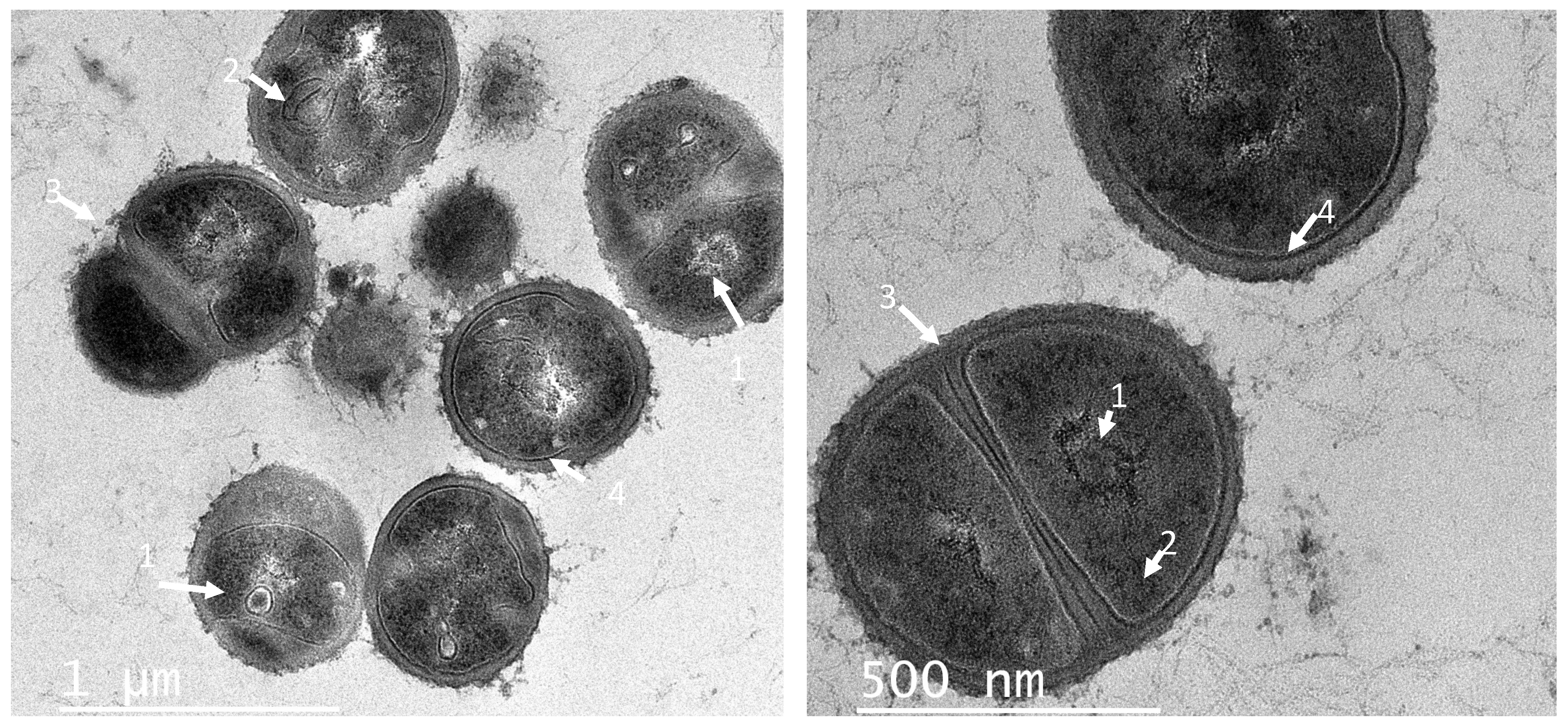 Antibiotics 11 00154 g004