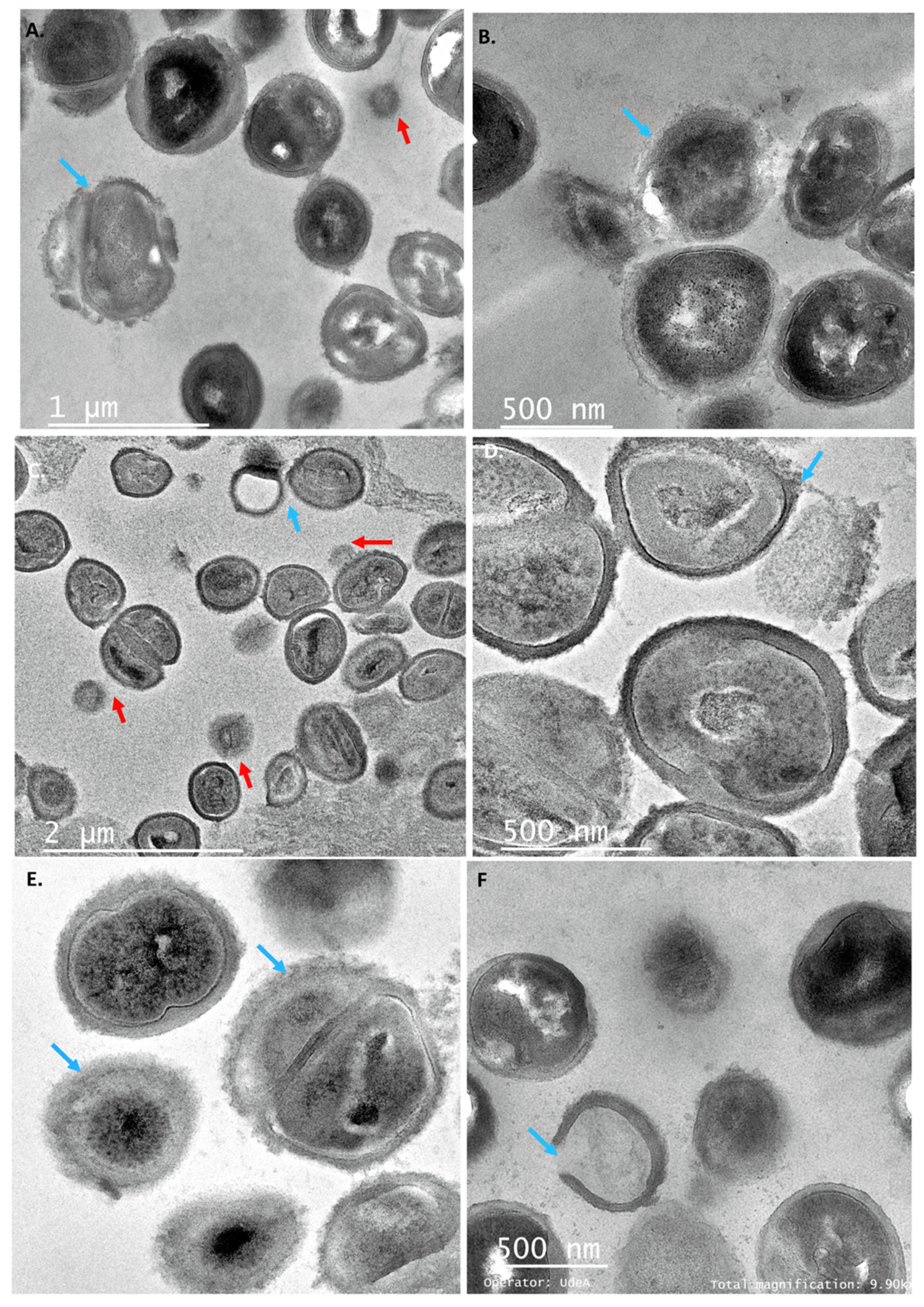 Antibiotics 11 00154 g005