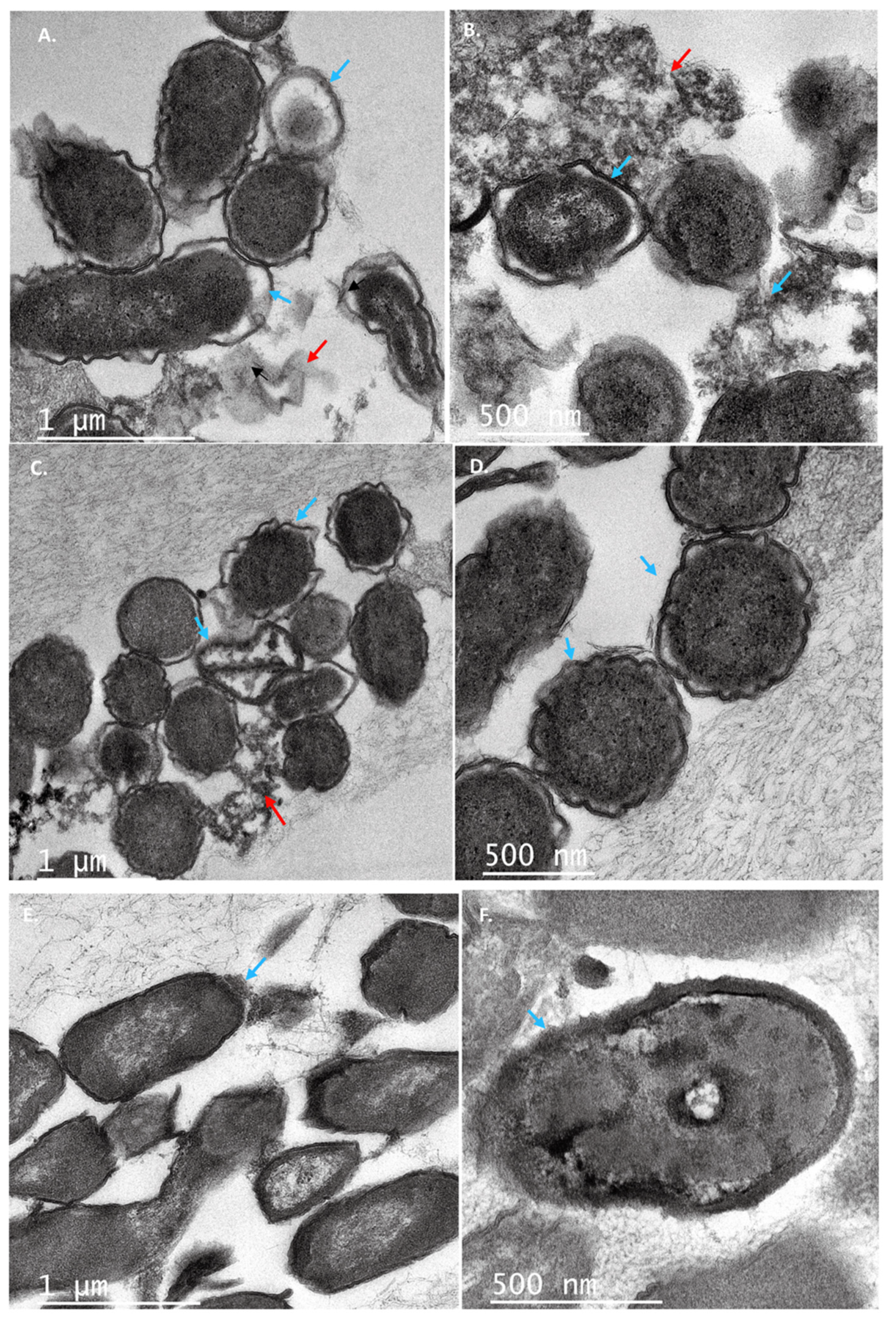 Antibiotics 11 00154 g007