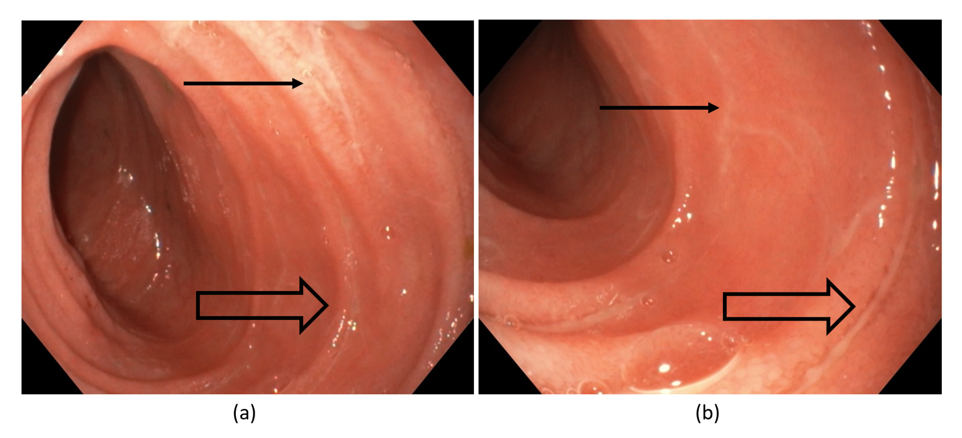 Antibiotics 11 00206 g001