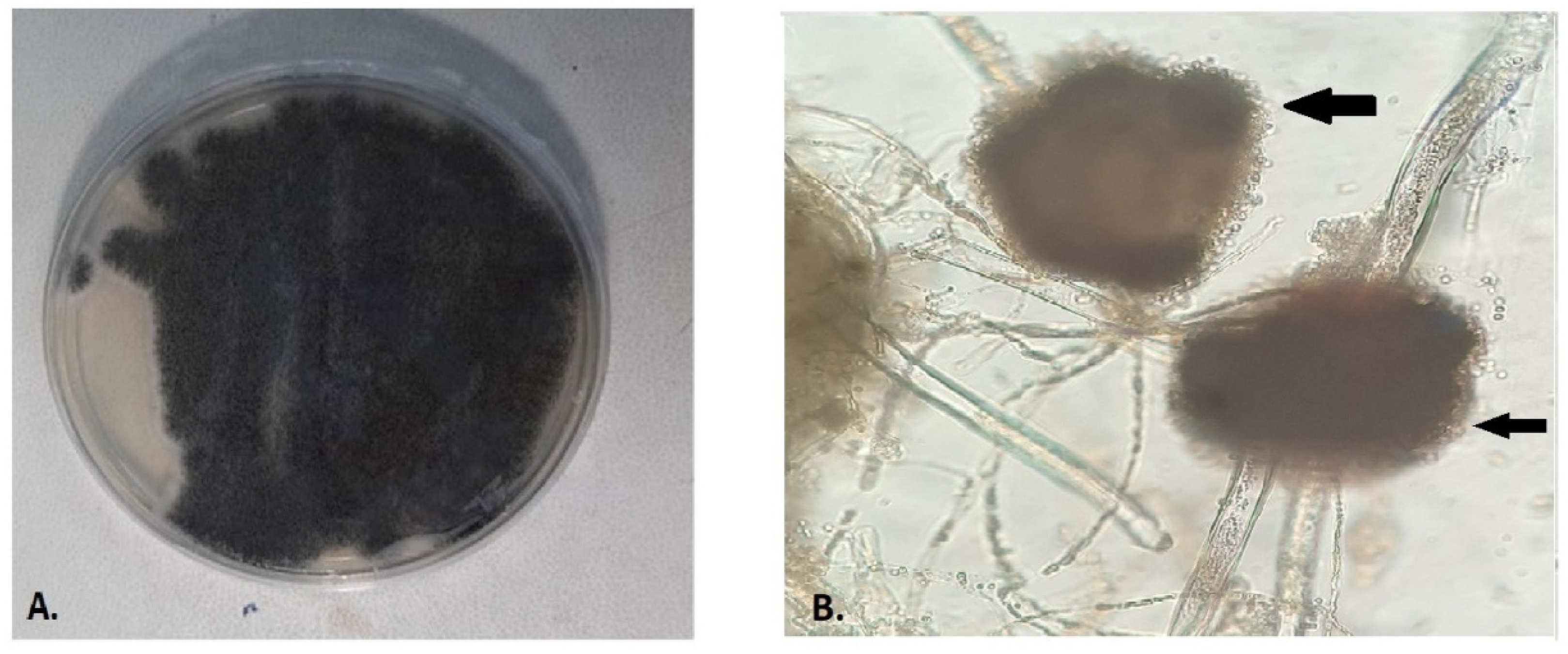 Antibiotics 11 00300 g001 550