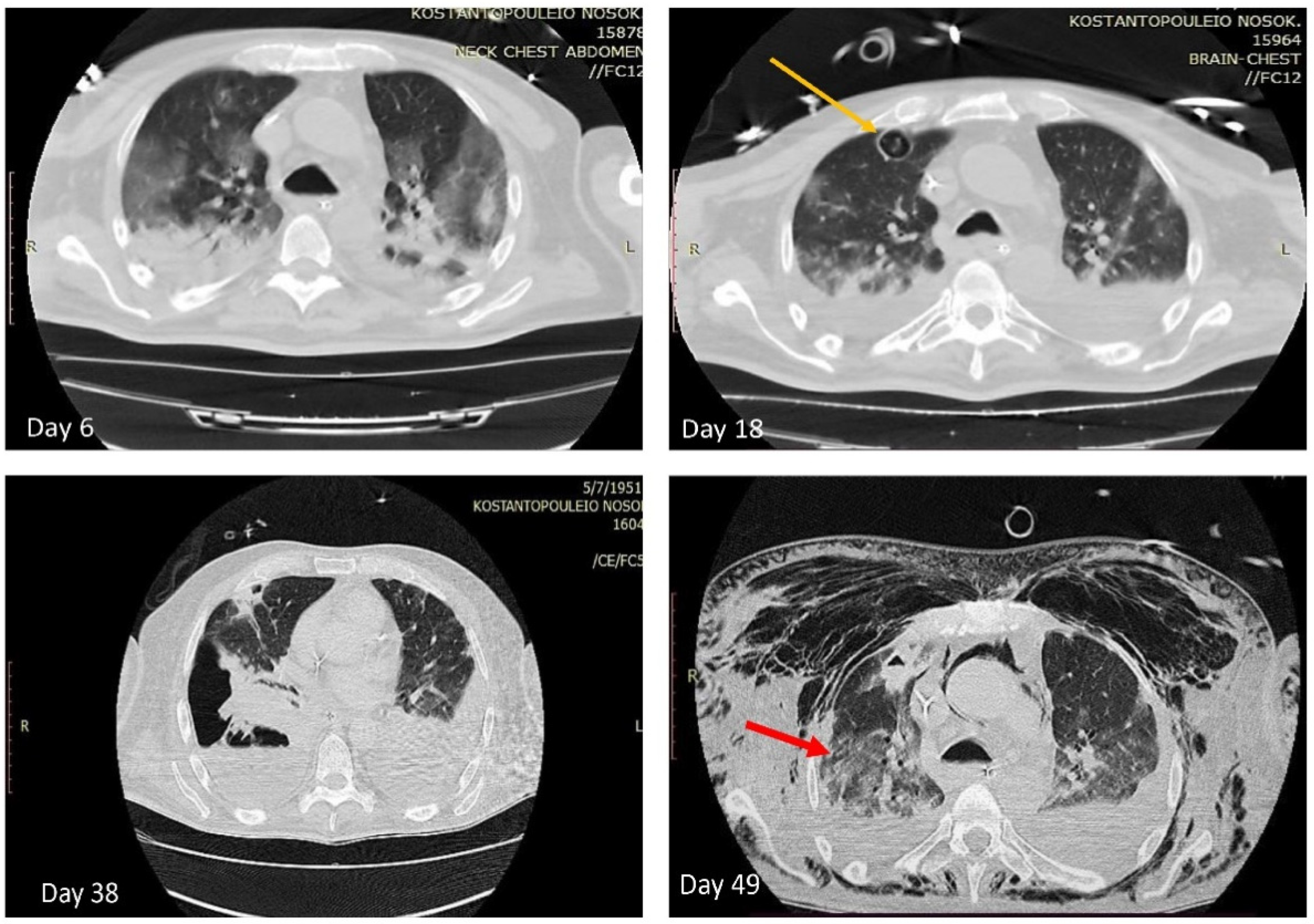 Antibiotics 11 00300 g002 550