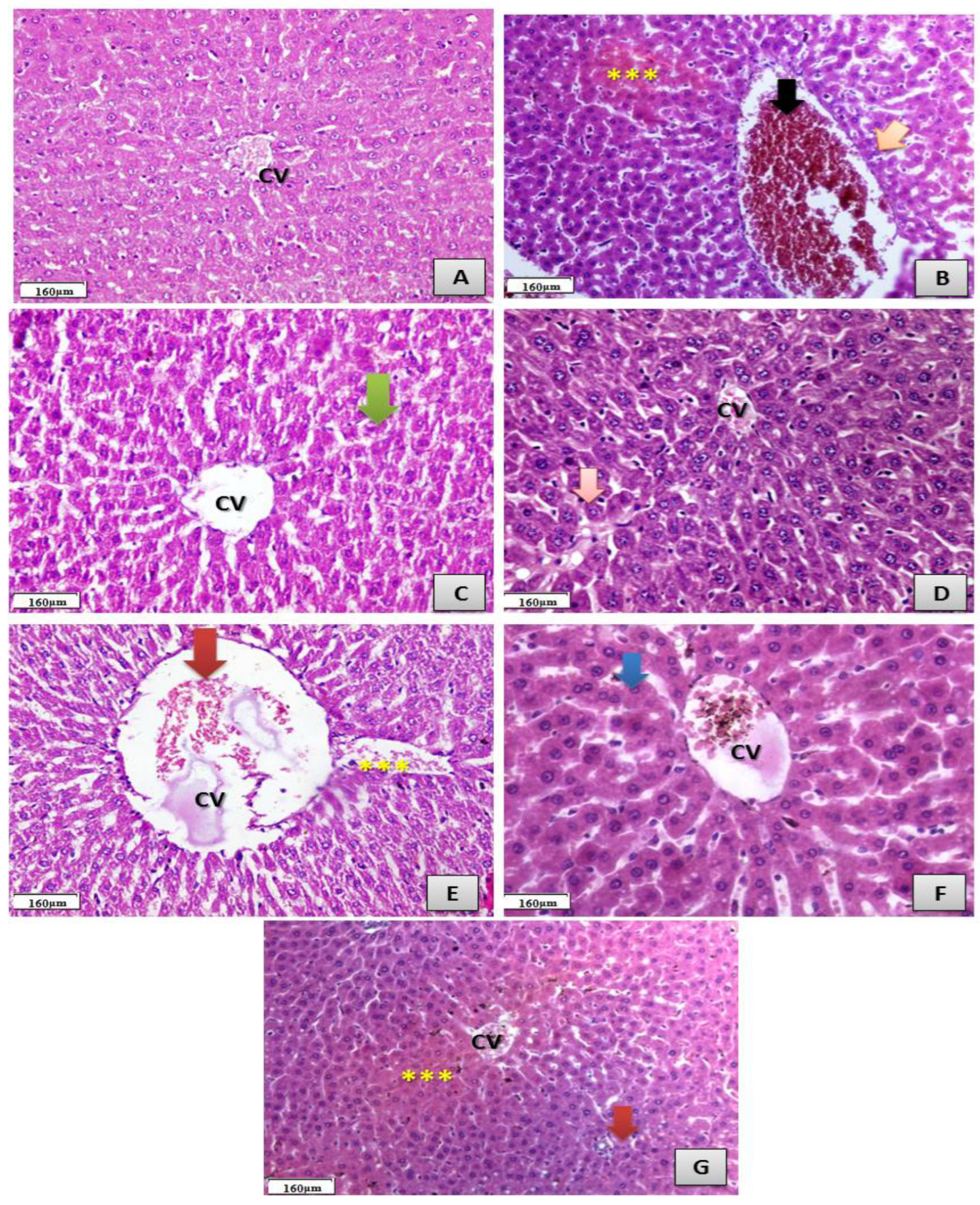 Antibiotics 11 00547 g008 Antibiotics 11 00547 g008