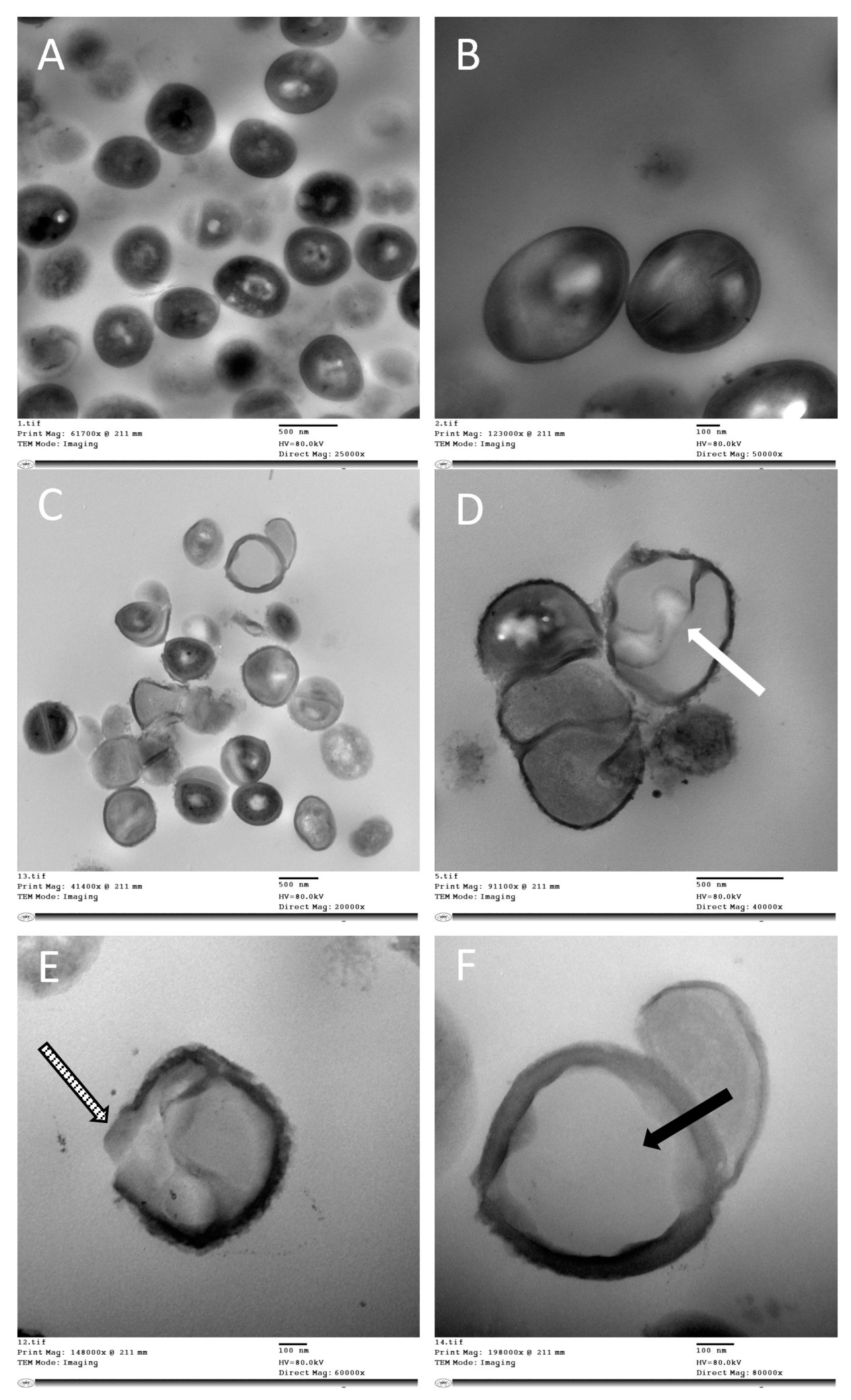 Antibiotics 11 00605 g004 Antibiotics 11 00605 g004