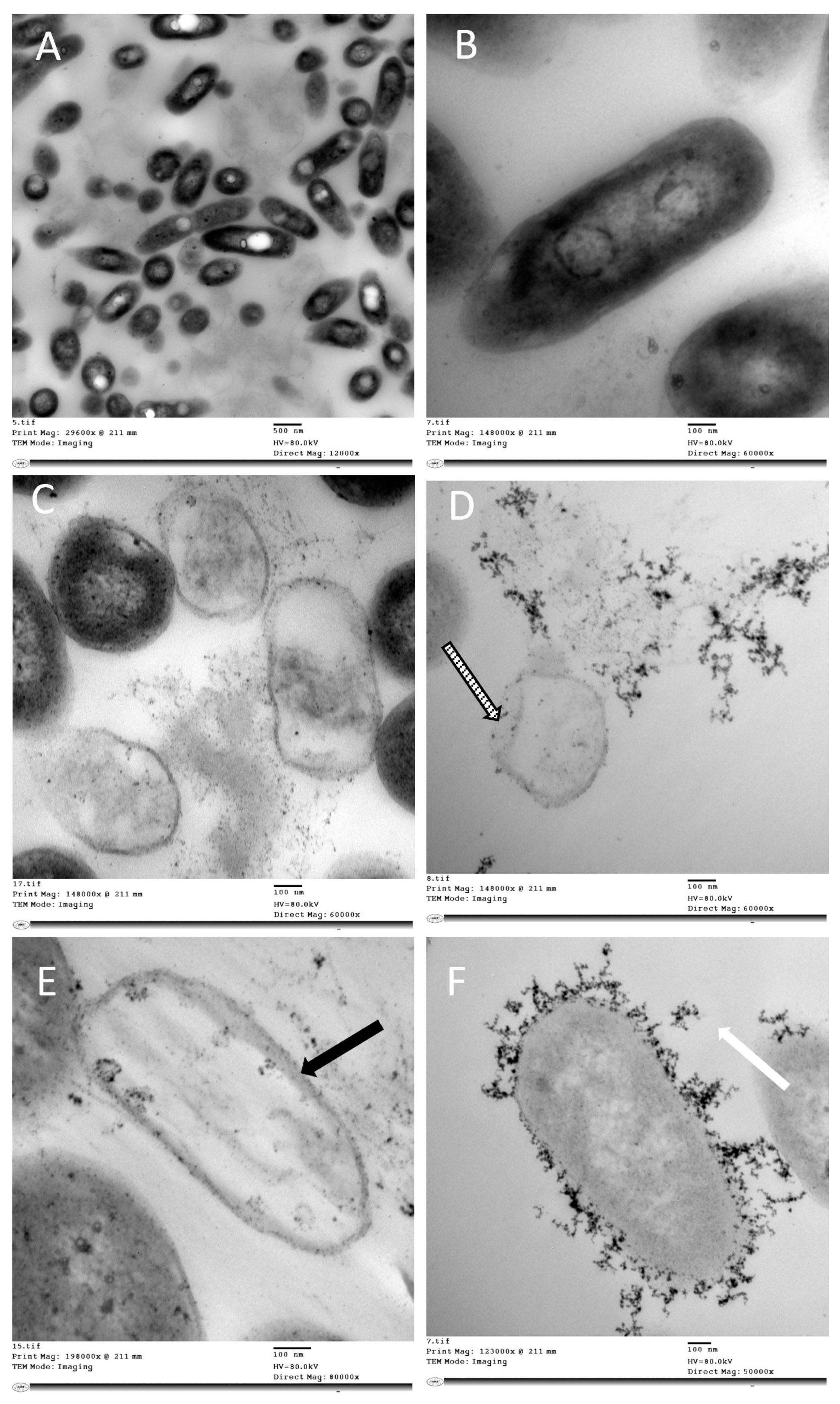 Antibiotics 11 00605 g005 Antibiotics 11 00605 g005