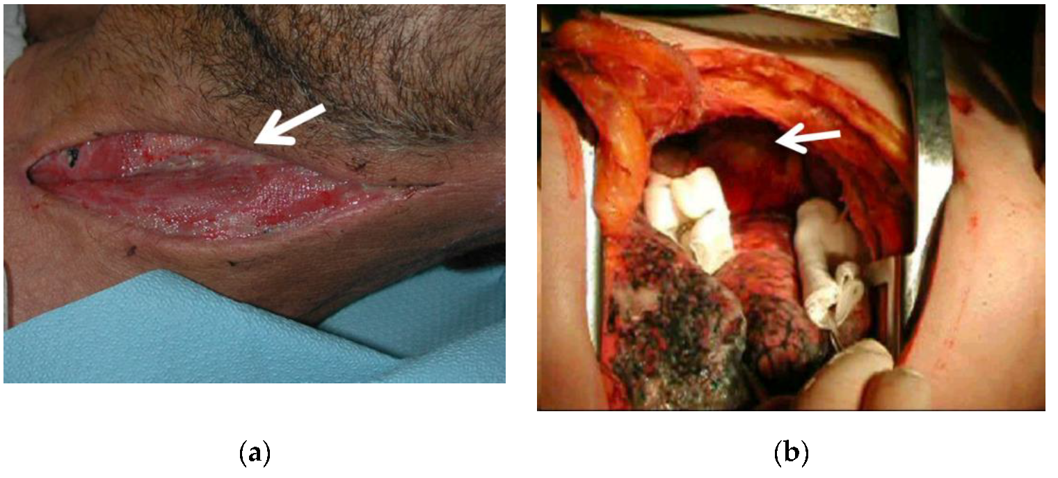 Antibiotics 11 00664 g002 550