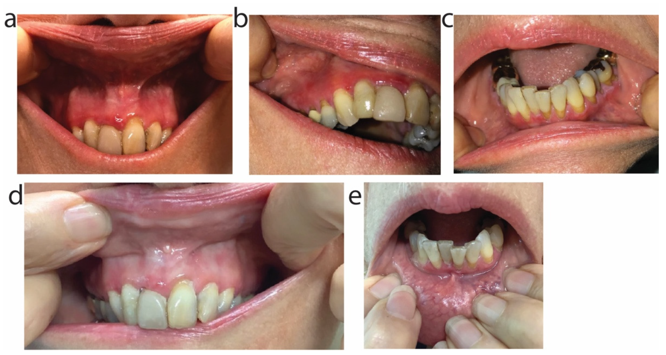 Antibiotics 11 00722 g007