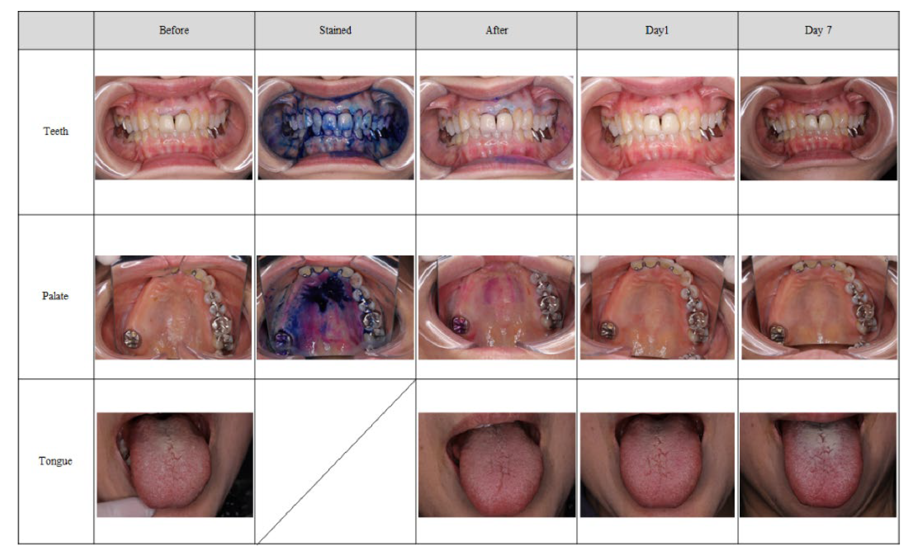Antibiotics 11 00825 g003 550