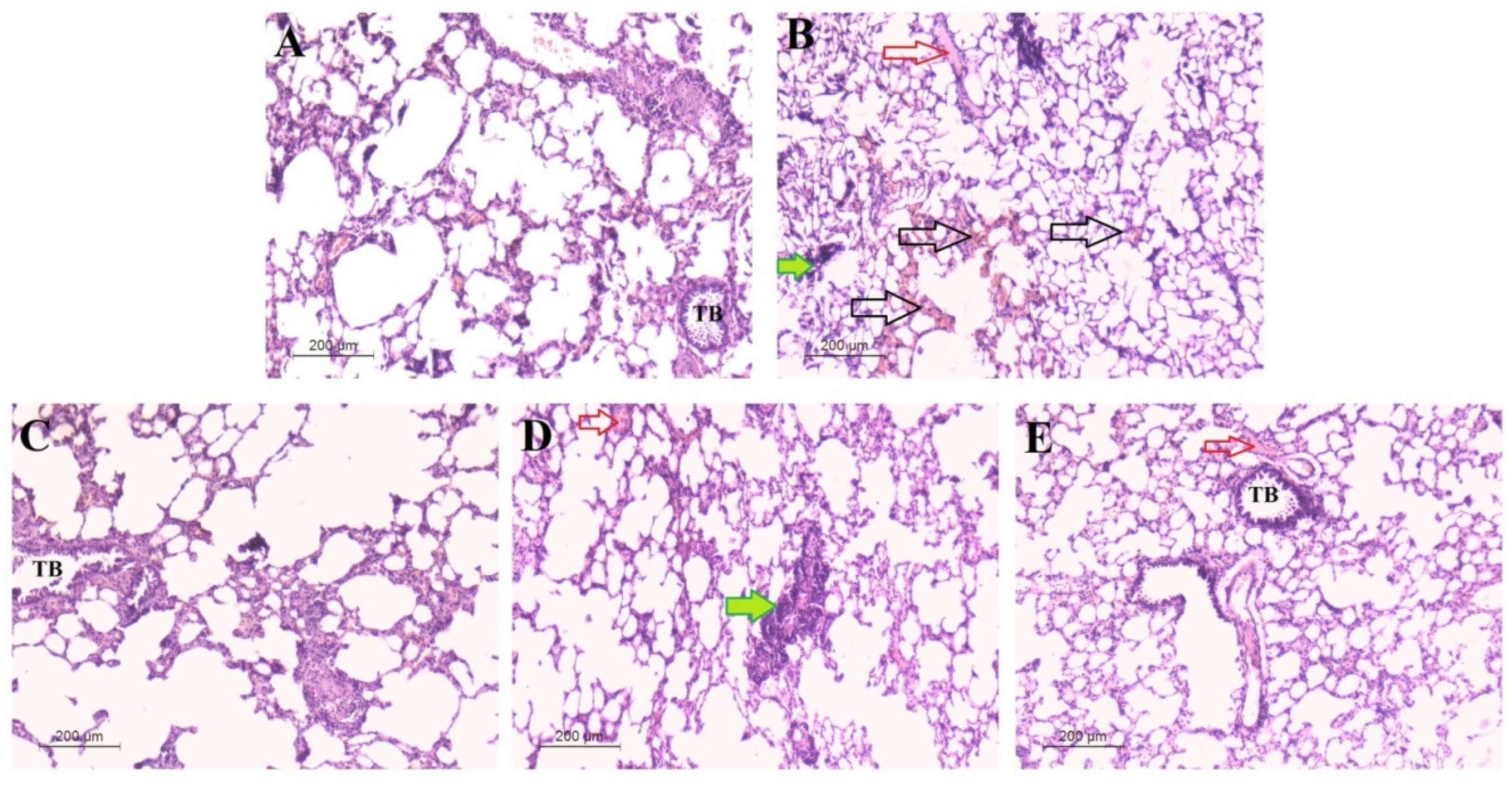 Antibiotics 11 00916 g014