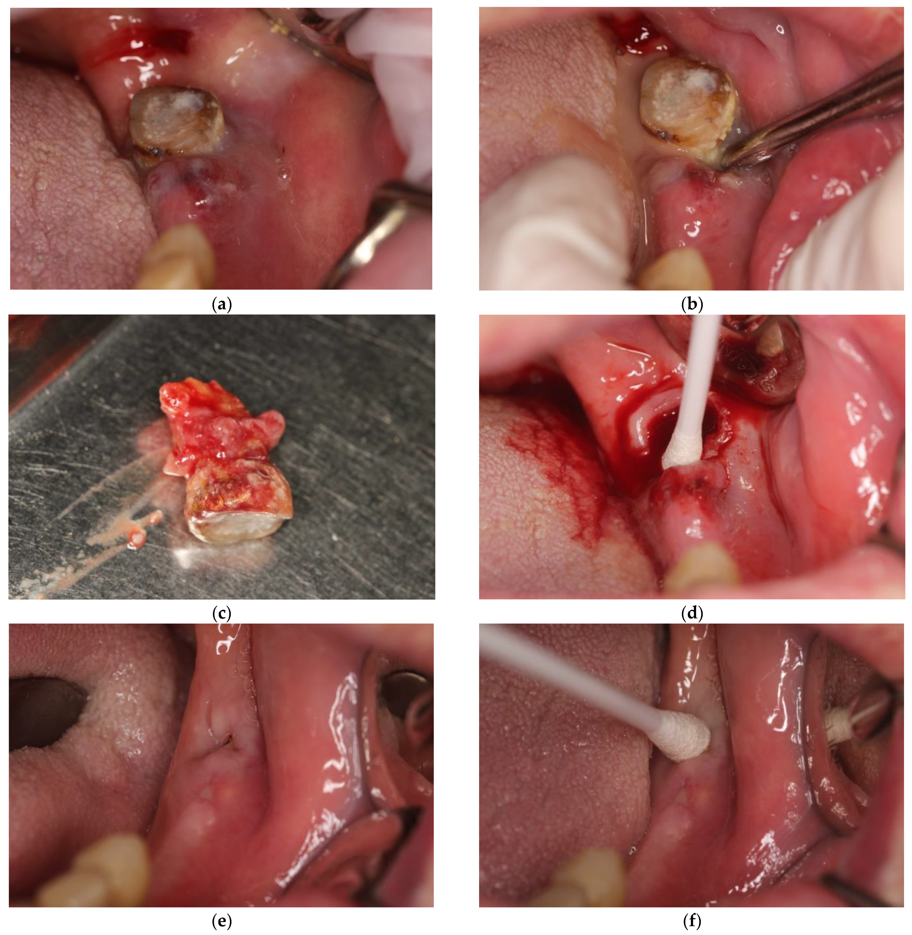 Antibiotics 11 01025 g002 Antibiotics 11 01025 g002