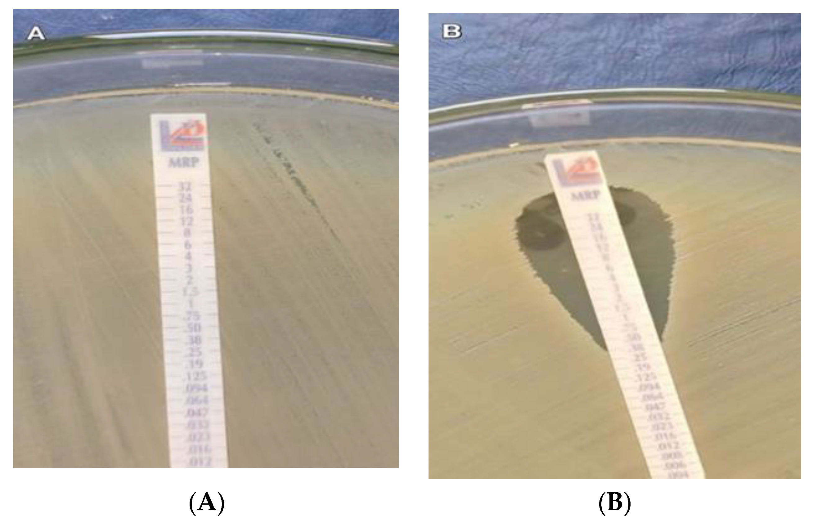 Antibiotics 11 01108 g001 Antibiotics 11 01108 g001