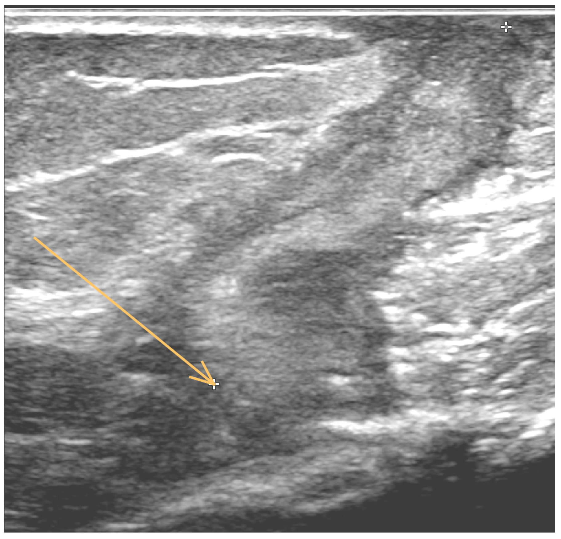 Antibiotics 11 01254 g001 Antibiotics 11 01254 g001