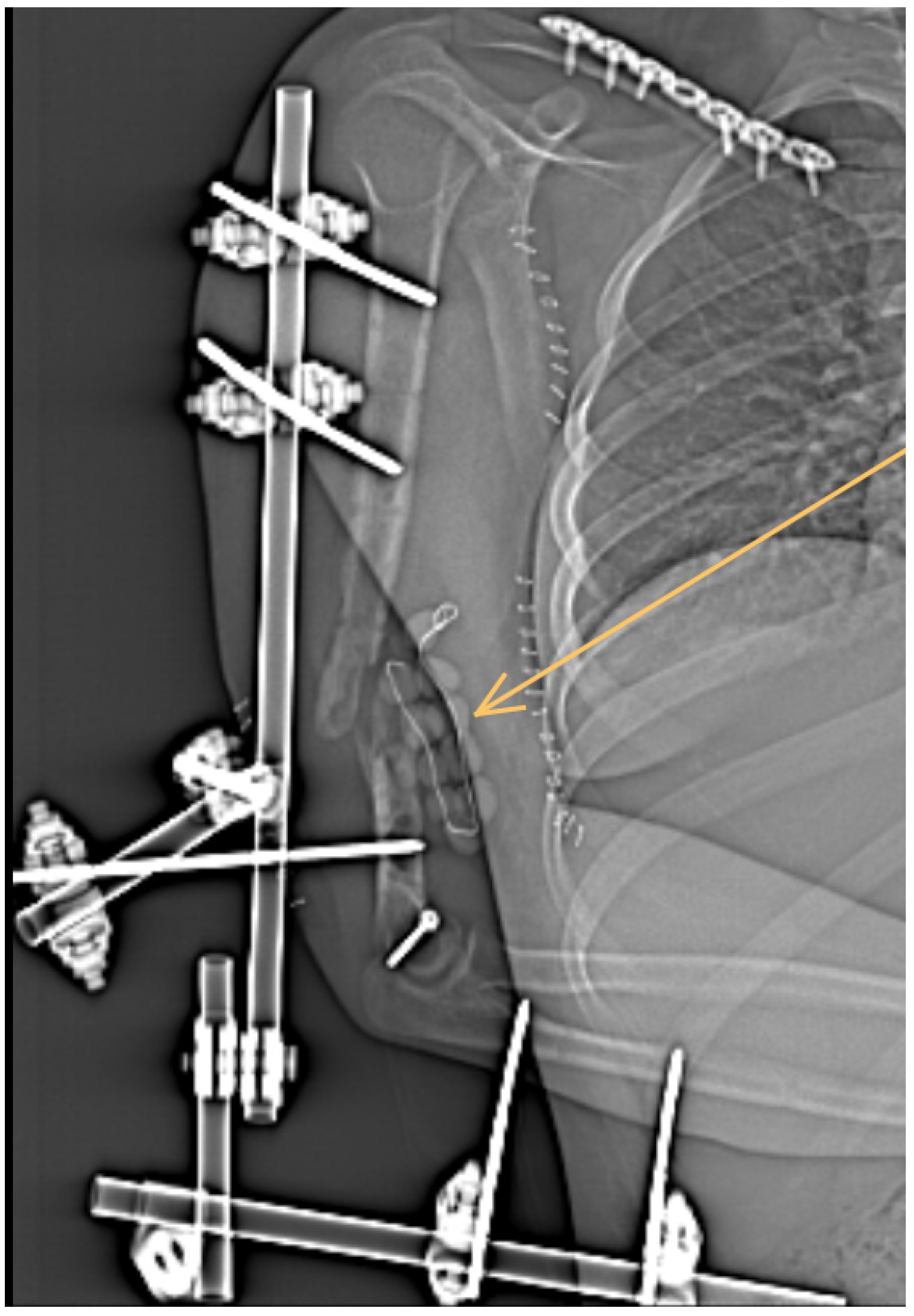 Antibiotics 11 01254 g002 Antibiotics 11 01254 g002