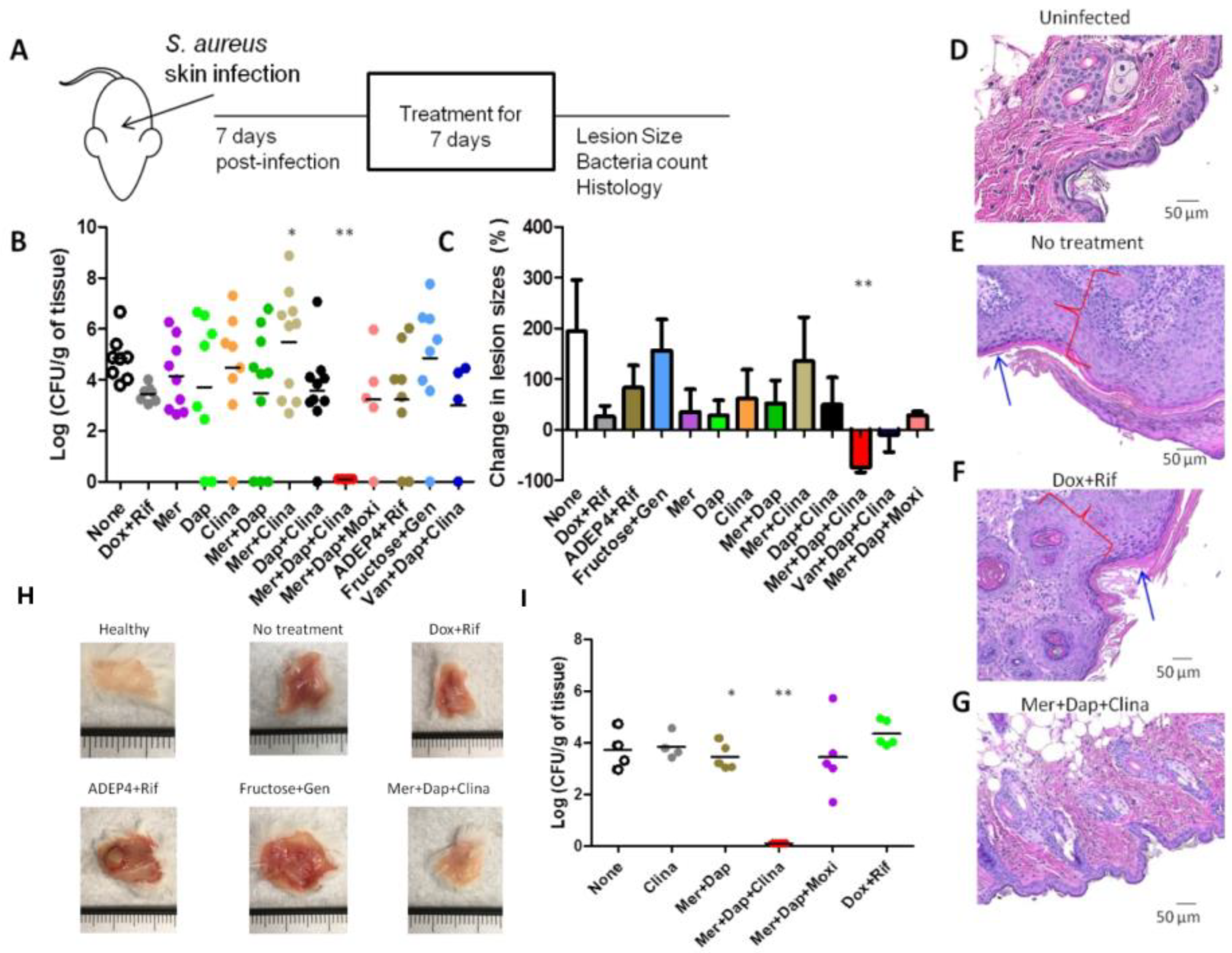 Treatment for S. aureus skin infection works in mouse model