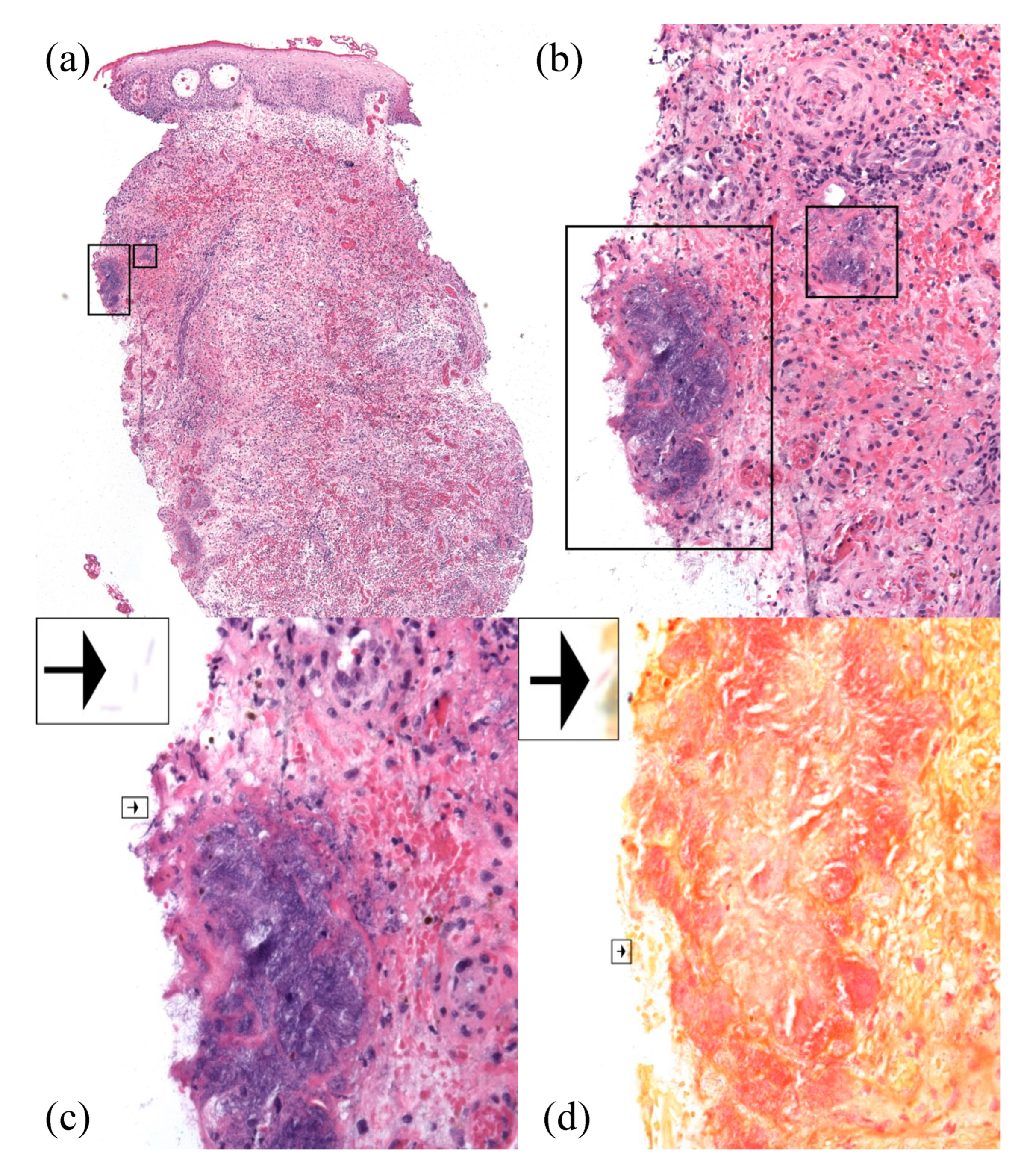 Antibiotics 11 01398 g002 Antibiotics 11 01398 g002