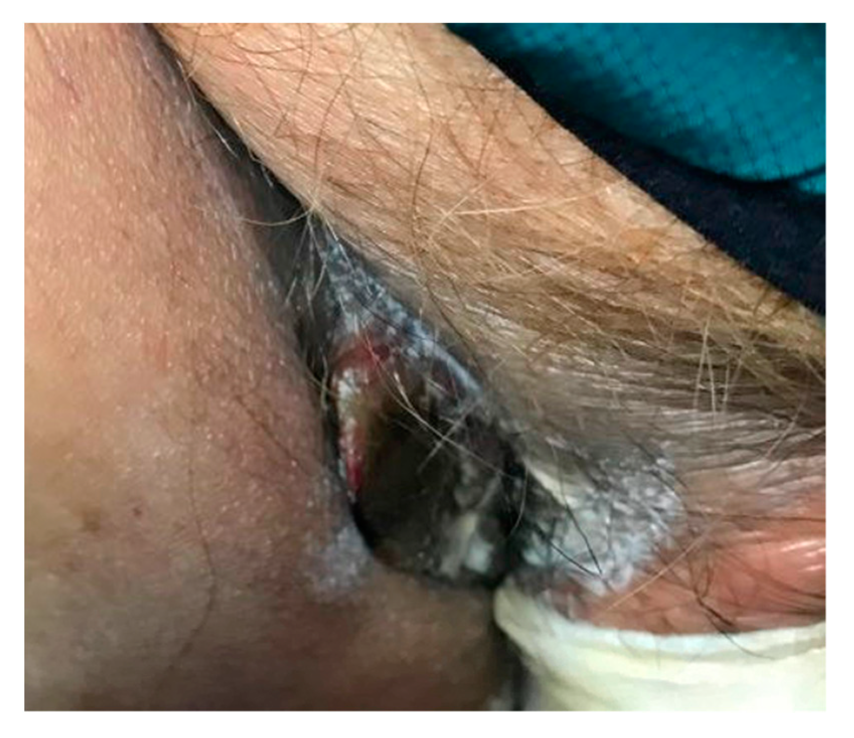 Antibiotics 11 01398 g003 Antibiotics 11 01398 g003