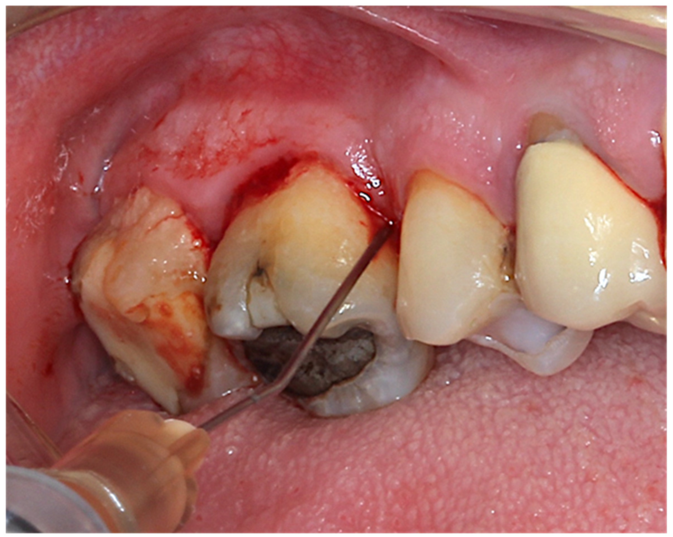 Antibiotics 11 01689 g003 Antibiotics 11 01689 g003