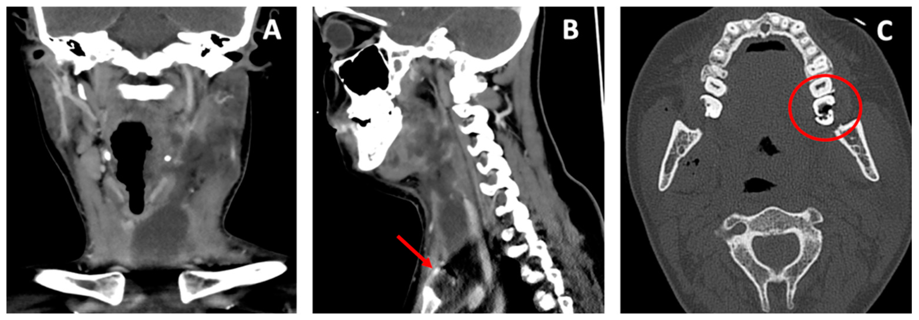 Antibiotics 11 01757 g001