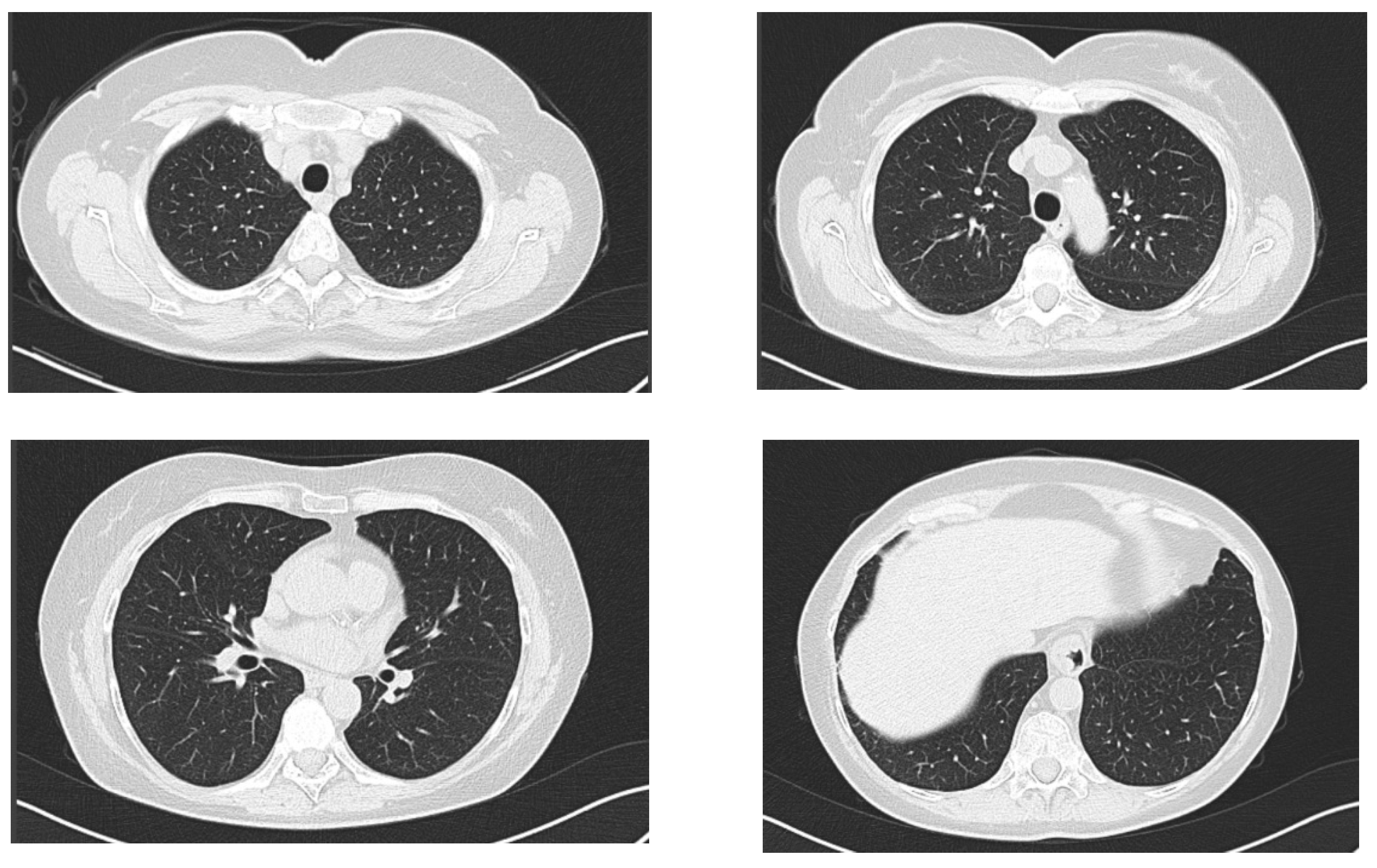 Antibiotics 12 00006 g003