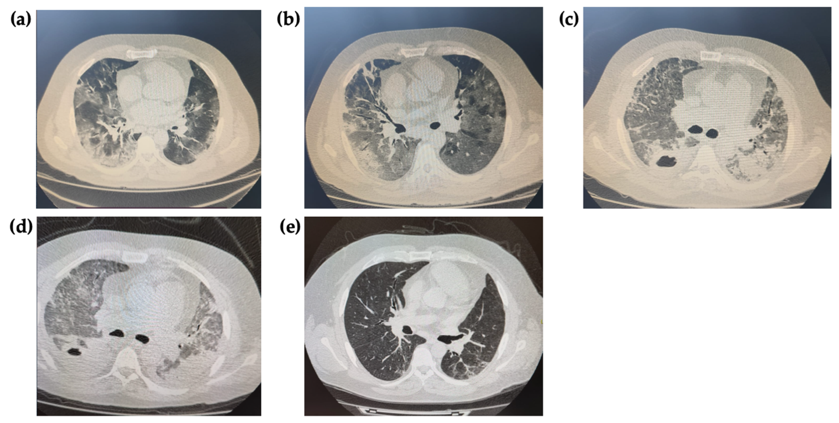 Antibiotics 12 00053 g002 Antibiotics 12 00053 g002