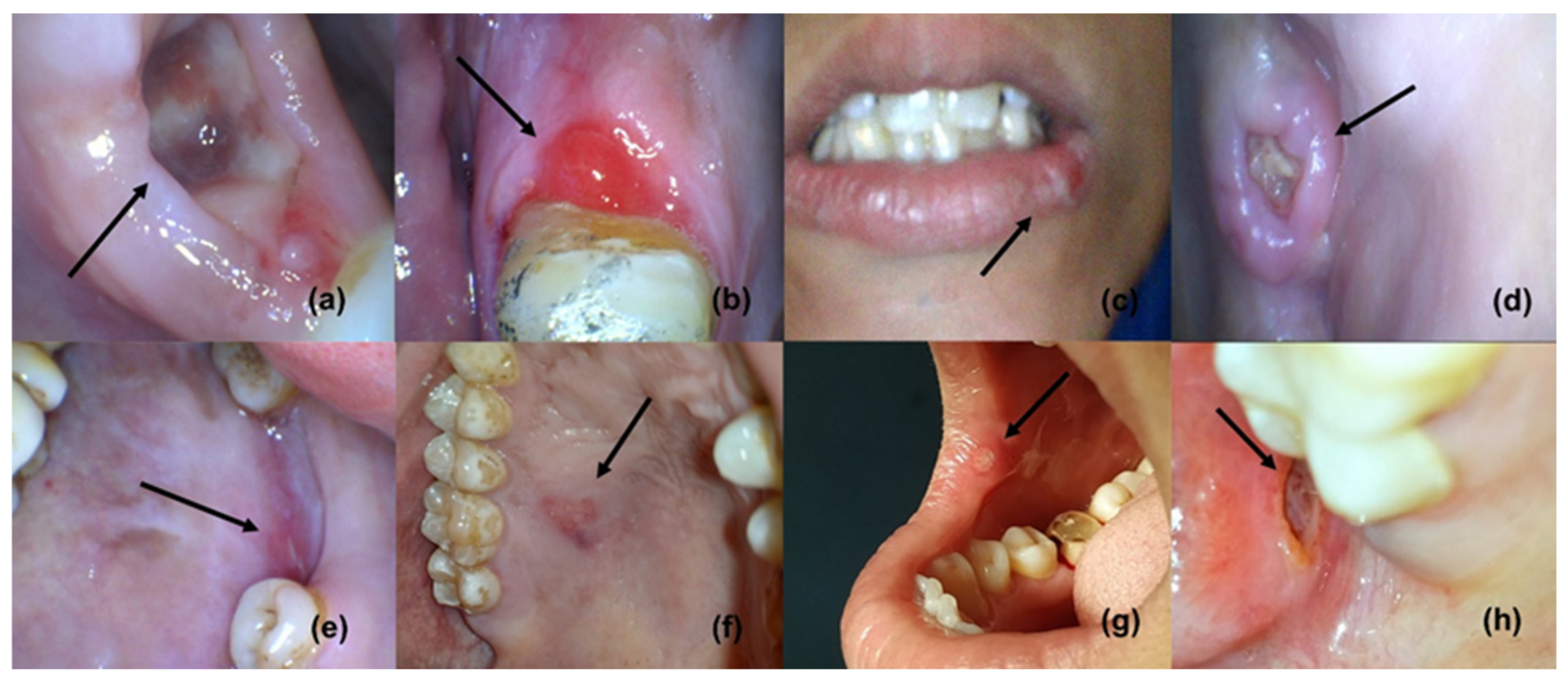 Antibiotics 12 00121 g001 Antibiotics 12 00121 g001