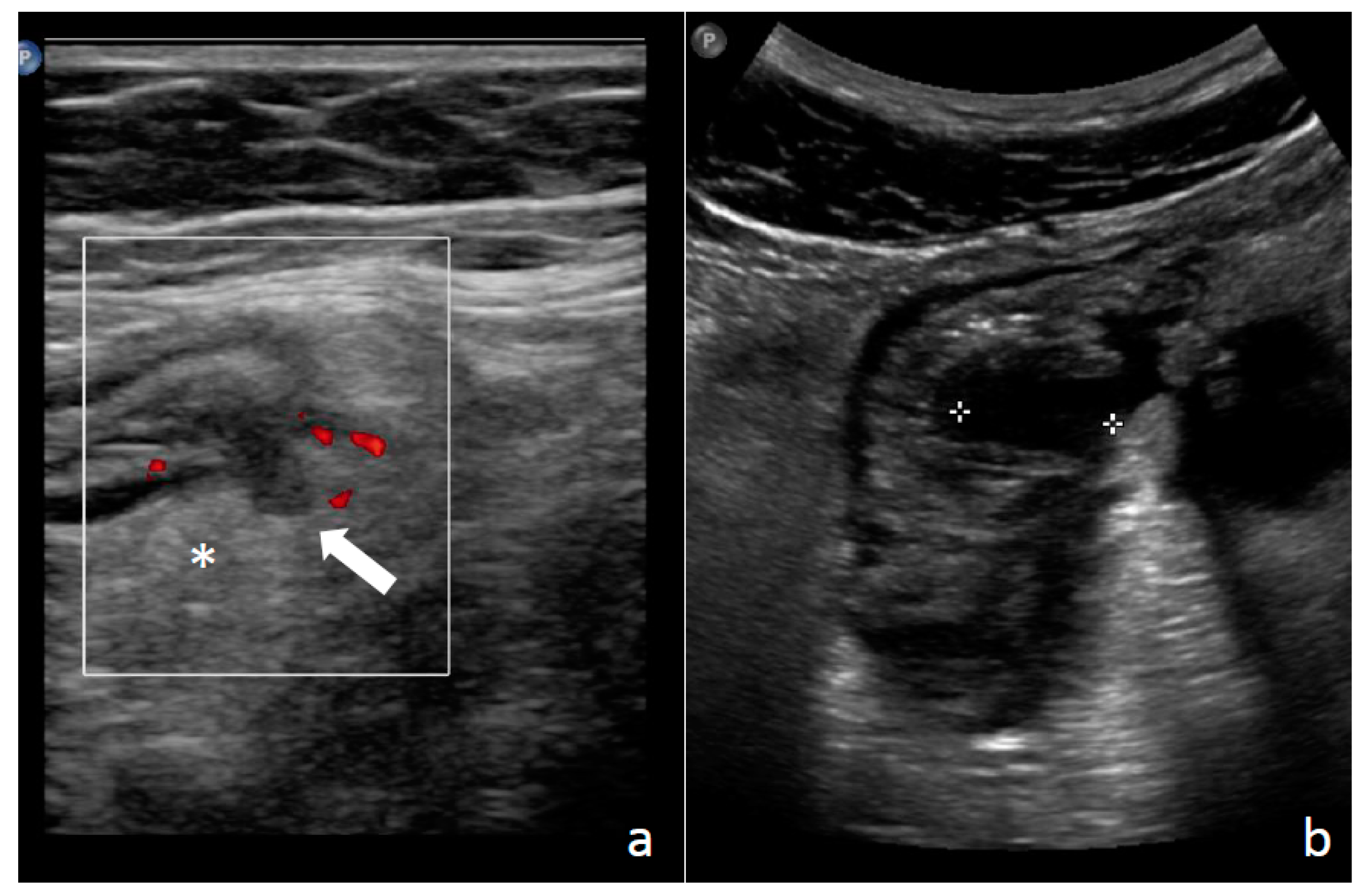 Antibiotics 12 00443 g002 Antibiotics 12 00443 g002