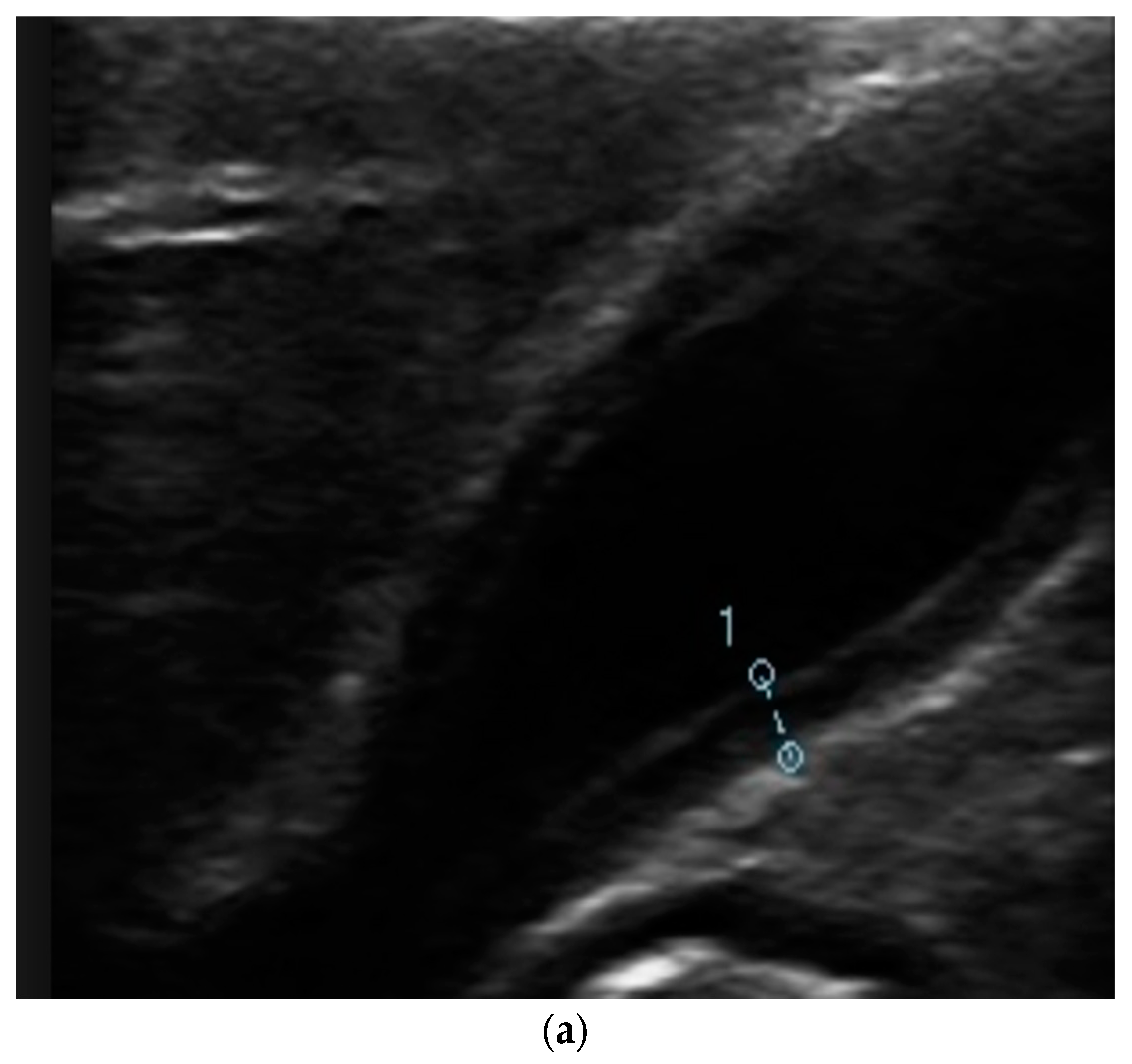 Antibiotics 12 00482 g001a
