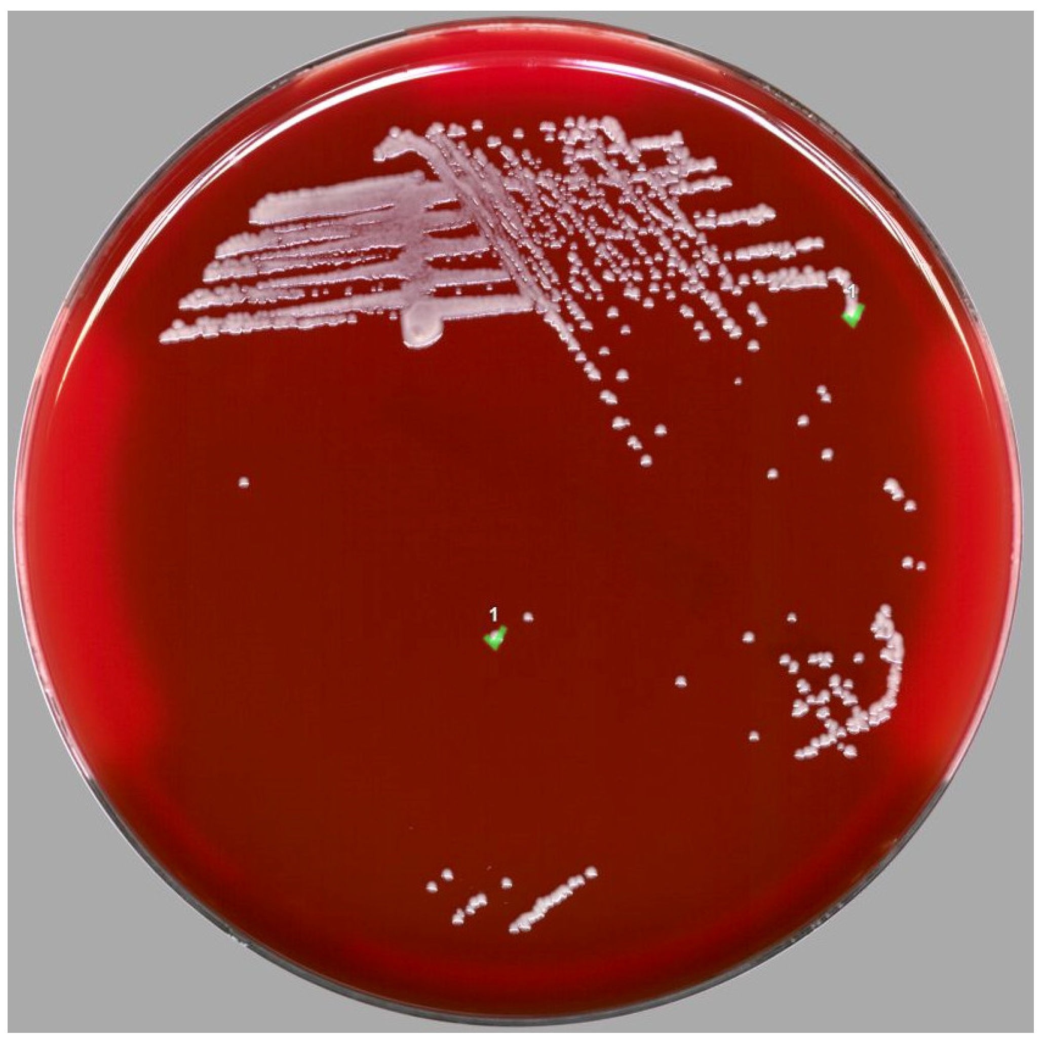 Antibiotics 12 00528 g001 Antibiotics 12 00528 g001