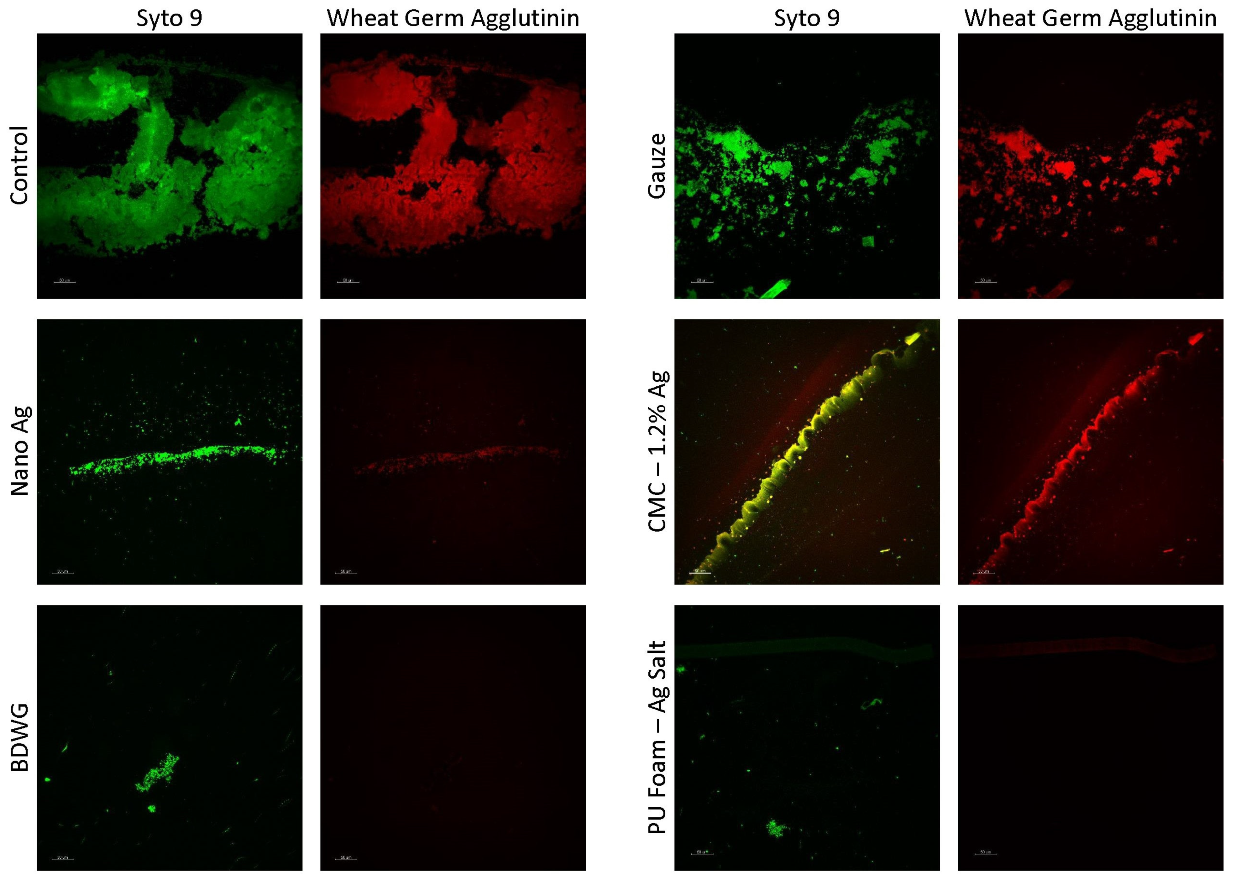 Antibiotics 12 00536 g004 Antibiotics 12 00536 g004