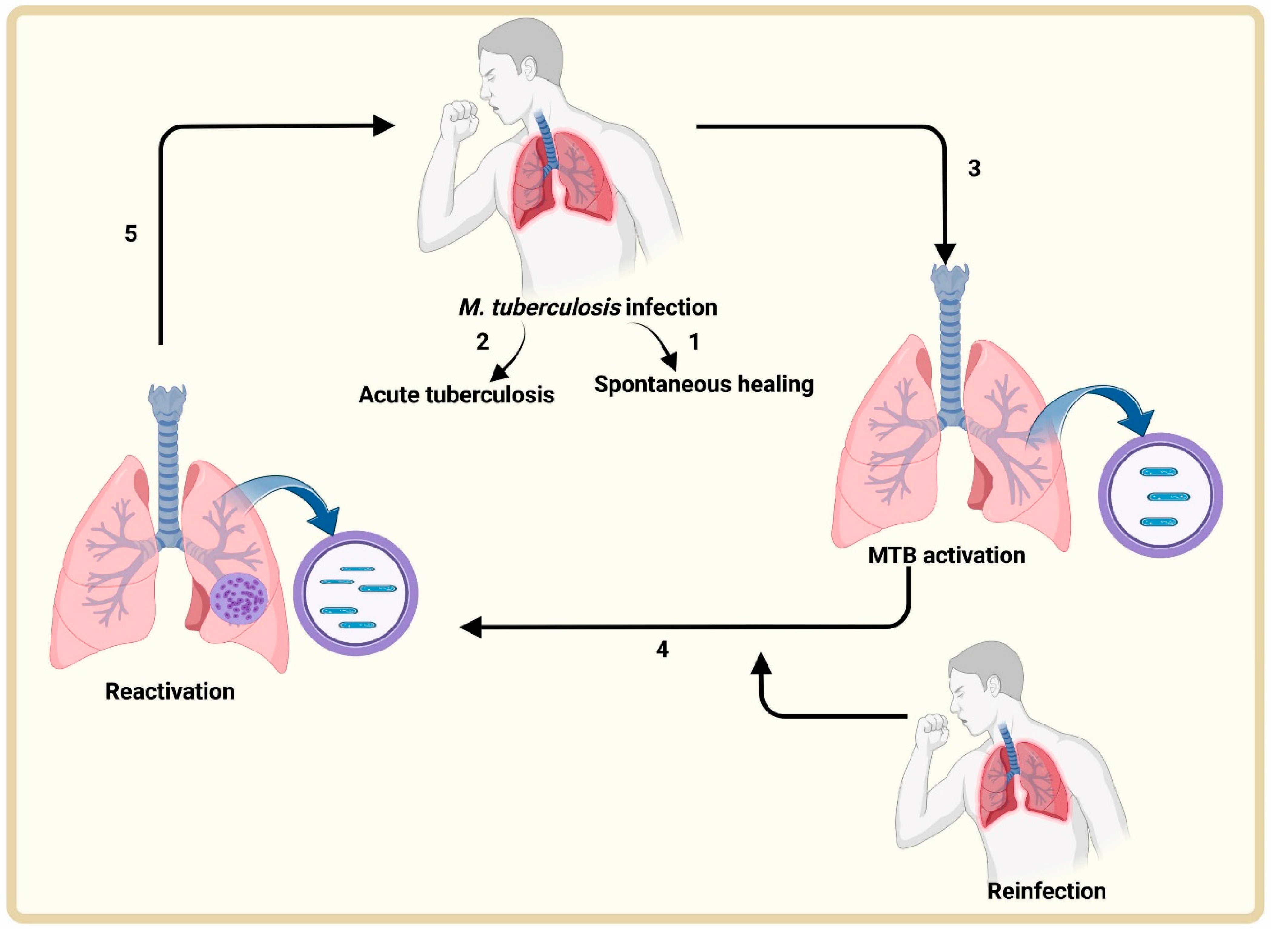 Mycobacterium Tuberculosis Diagram mycobacterium-tuberculosis-diagram
