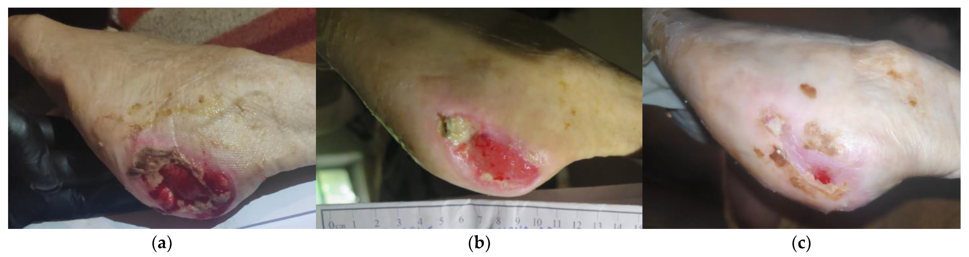 Antibiotics 12 00605 g002 Antibiotics 12 00605 g002
