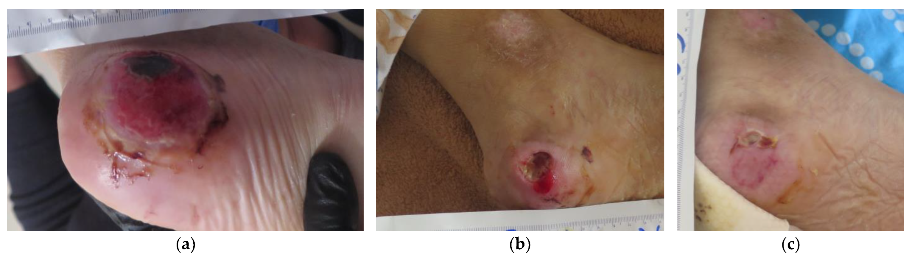 Antibiotics 12 00605 g003 Antibiotics 12 00605 g003