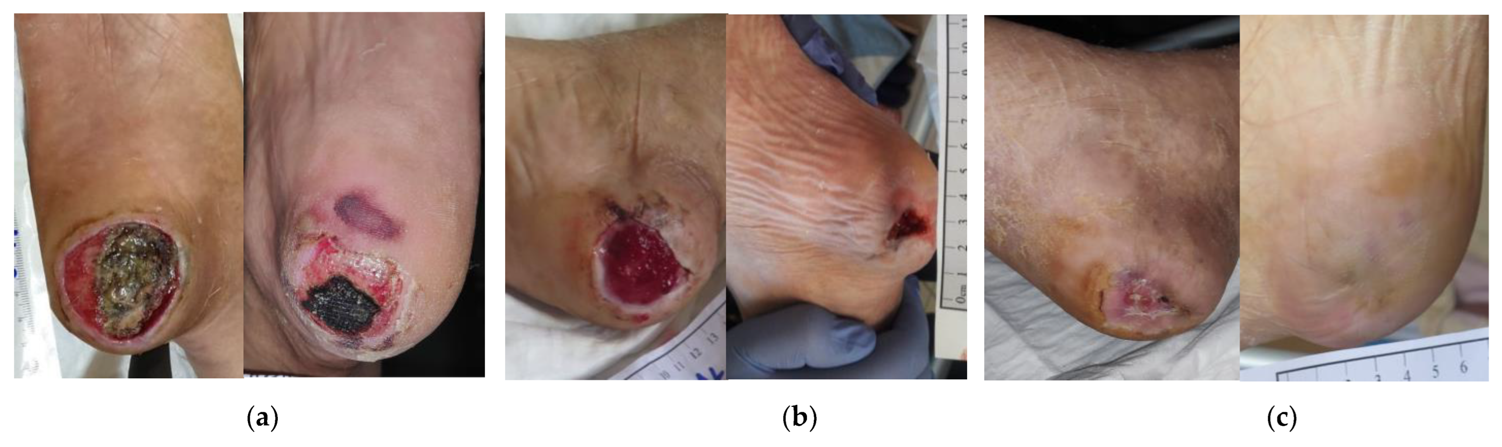 Antibiotics 12 00605 g007 Antibiotics 12 00605 g007
