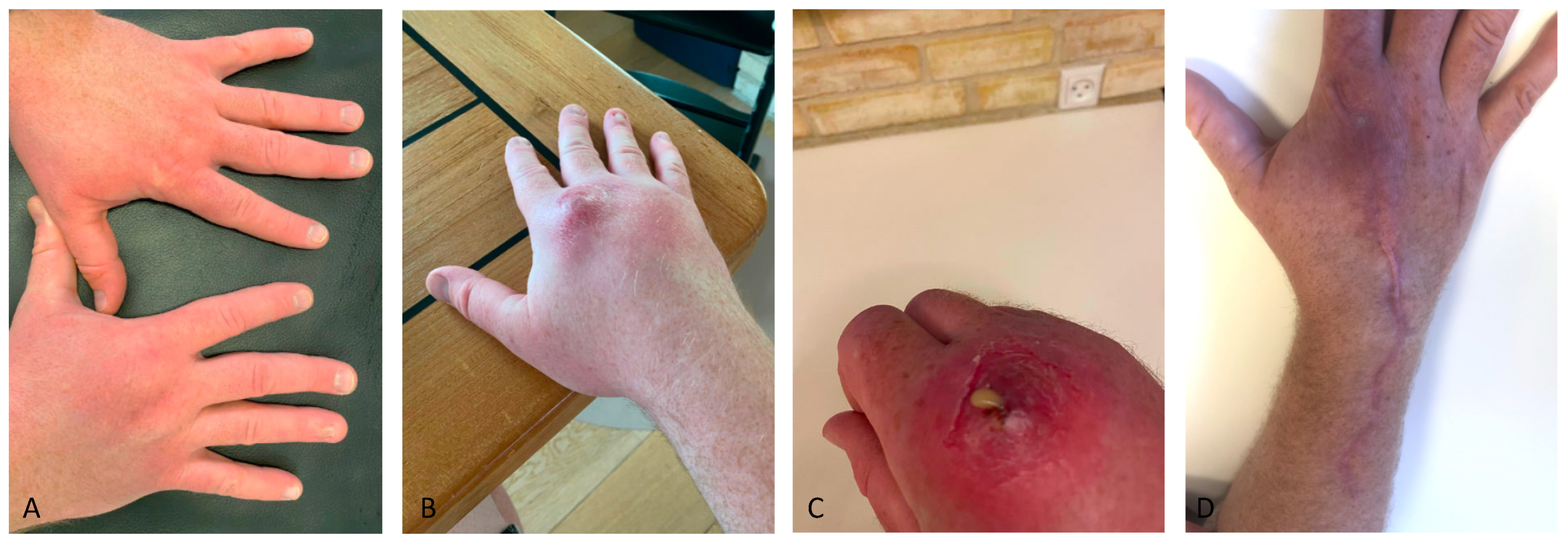 Antibiotics 12 00629 g002