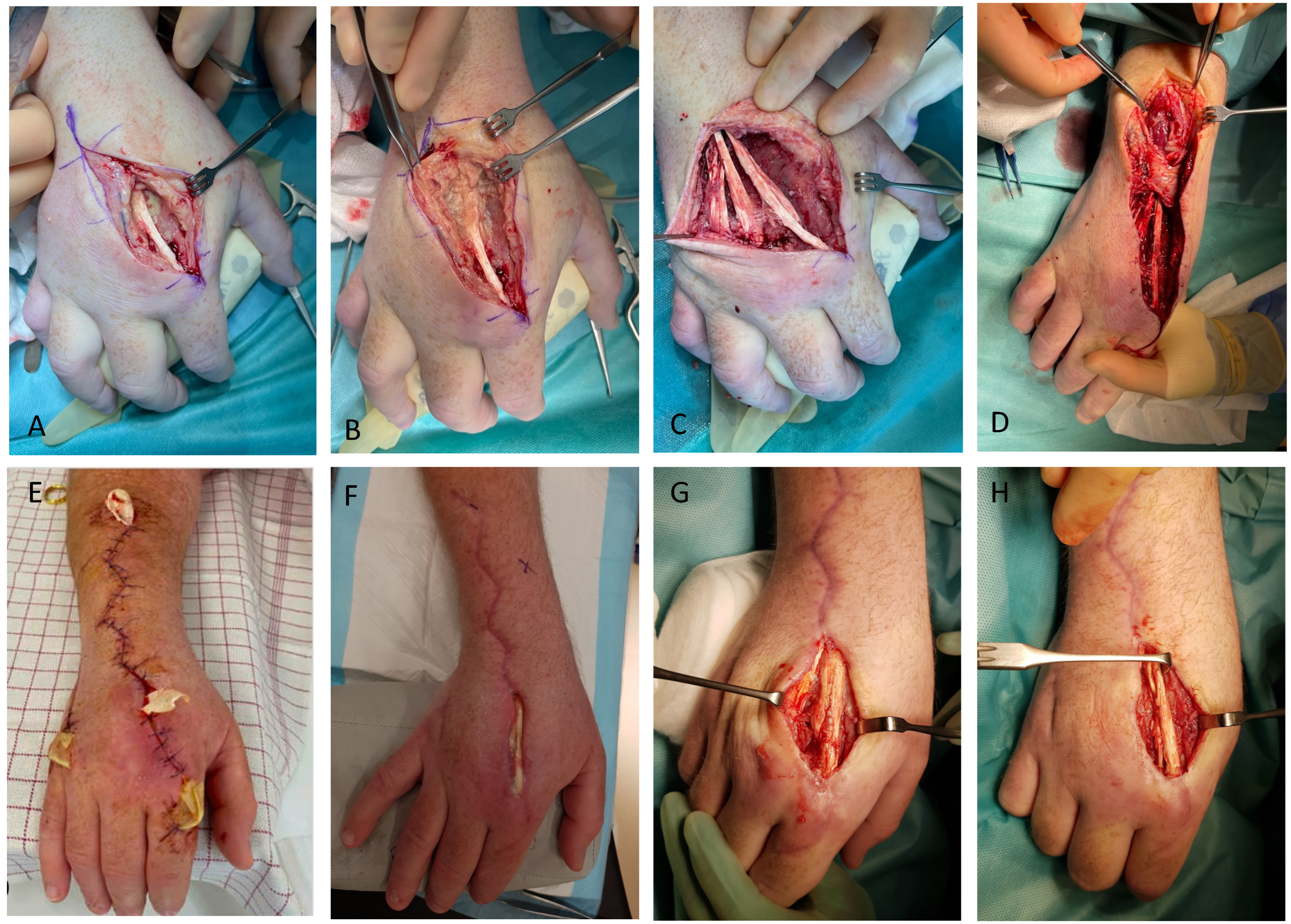 Antibiotics 12 00629 g004