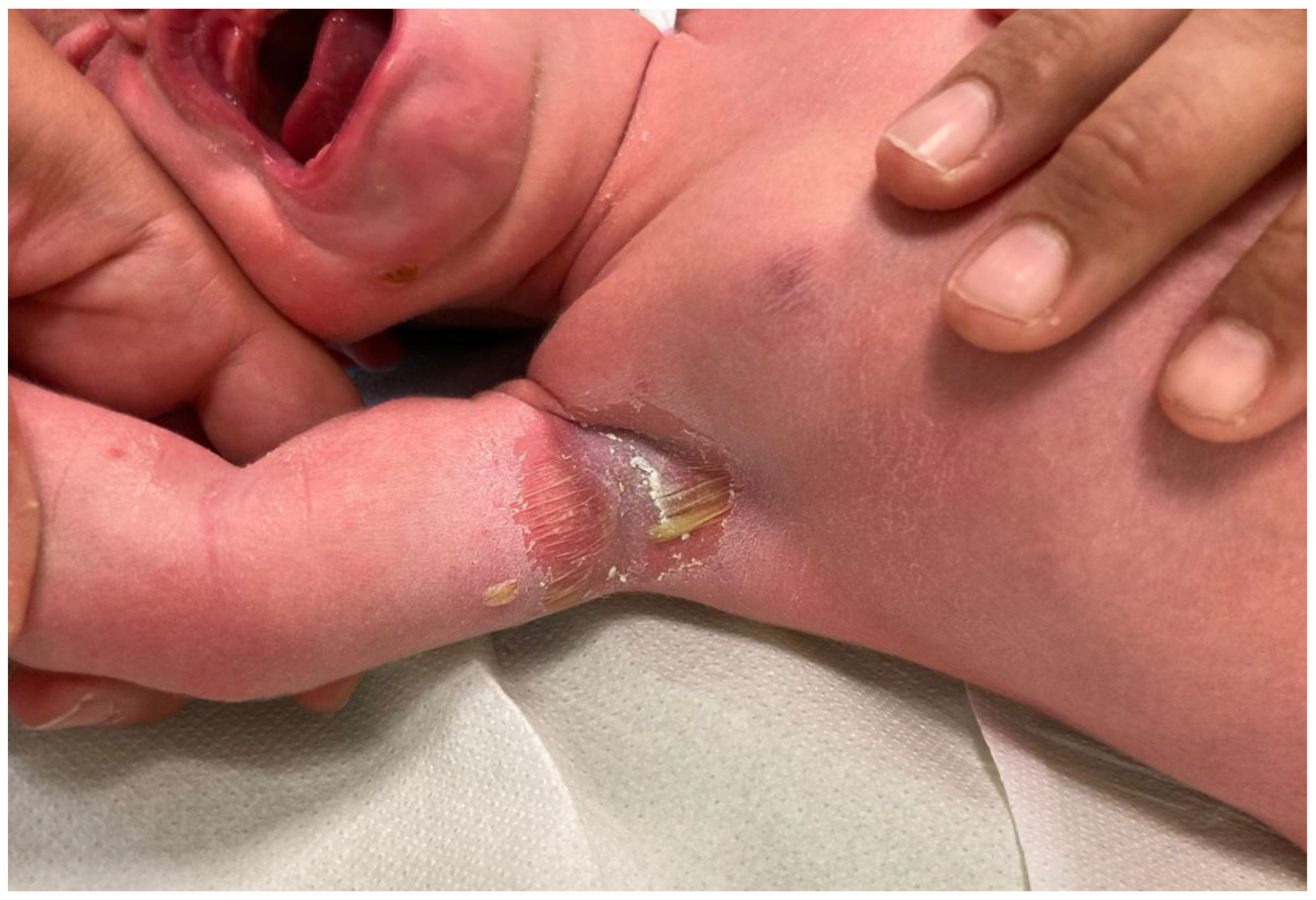 Antibiotics 12 00632 g002