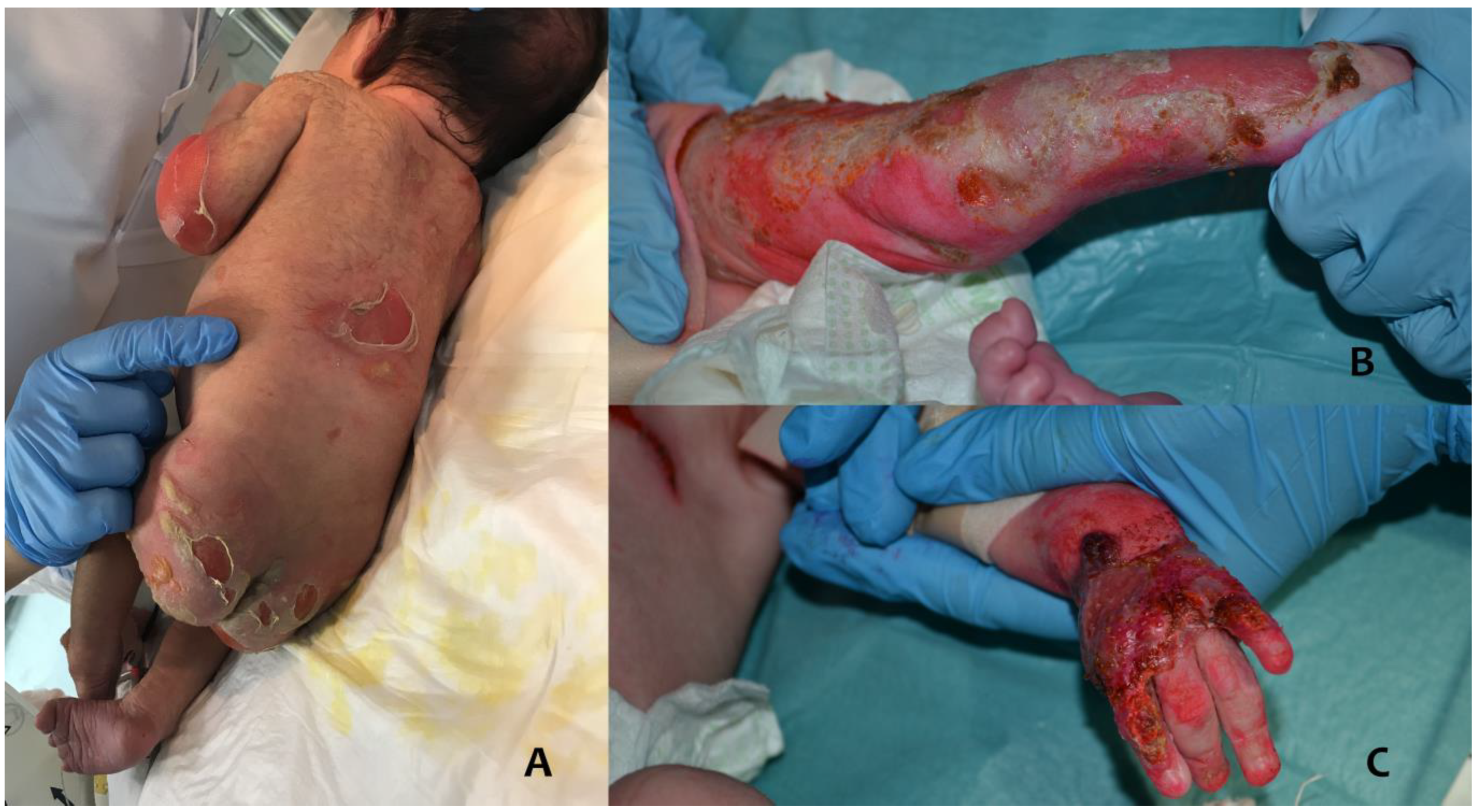 Antibiotics 12 00632 g003