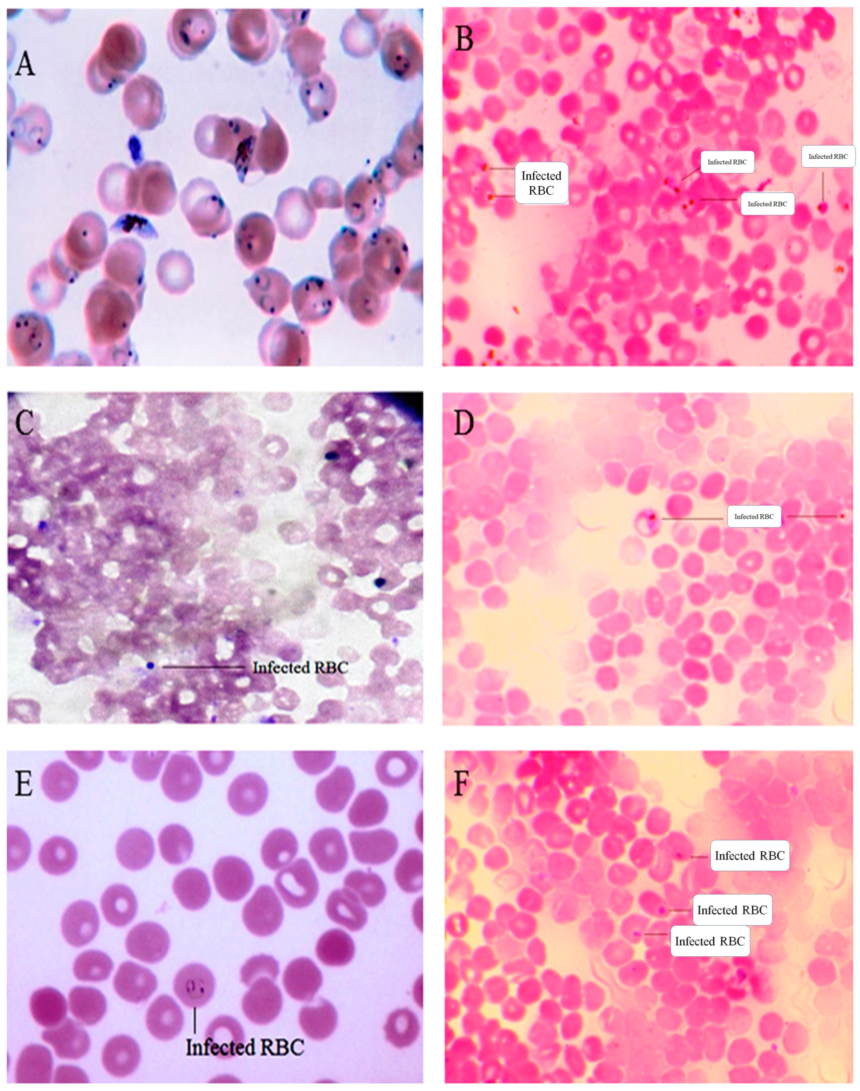 Antibiotics 12 00688 g014 Antibiotics 12 00688 g014
