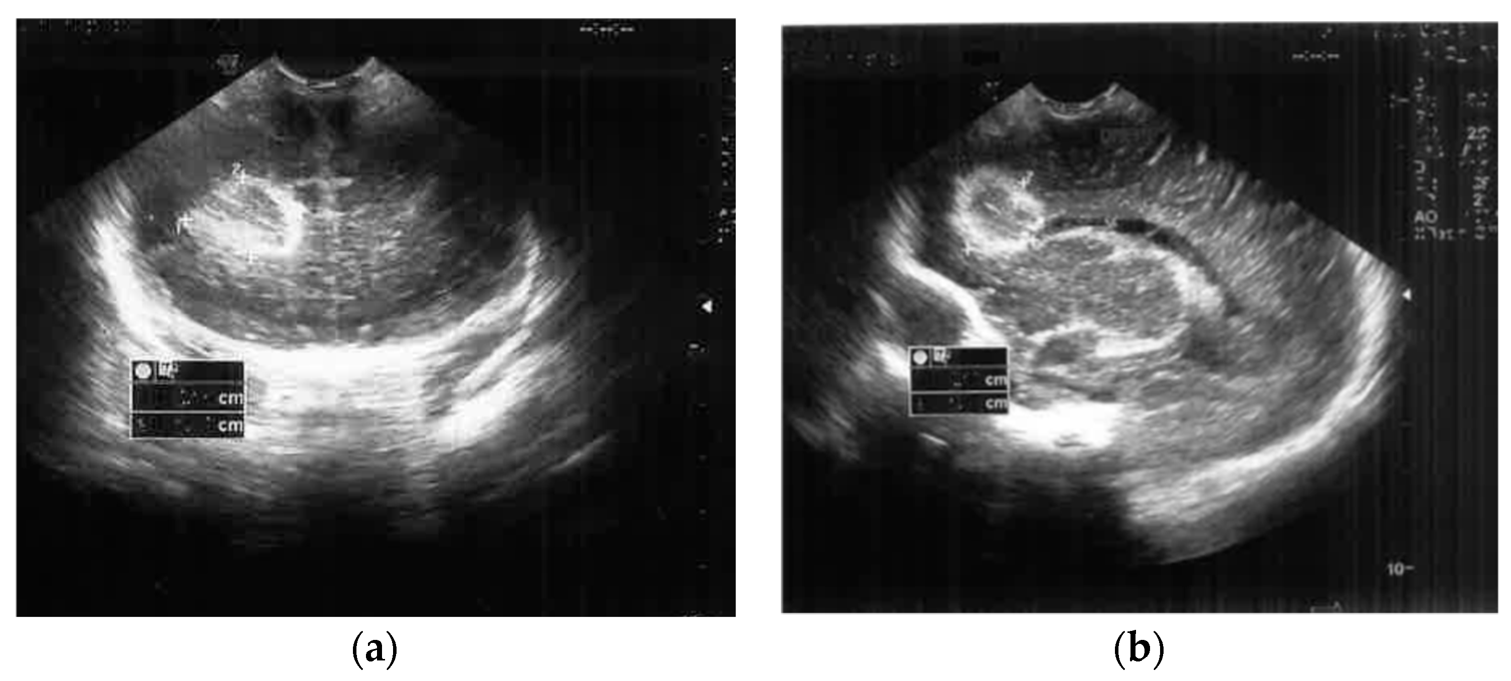 Antibiotics 12 00722 g001 Antibiotics 12 00722 g001