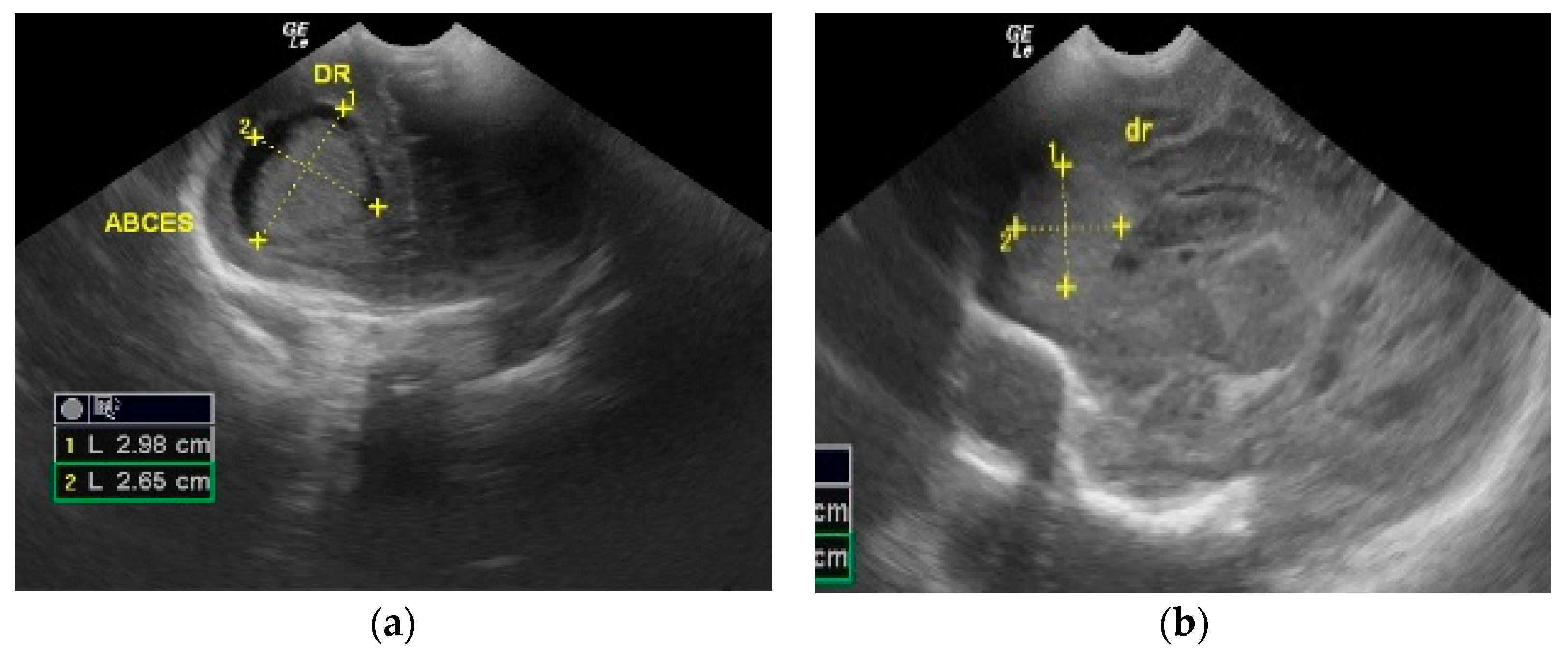 Antibiotics 12 00722 g002 Antibiotics 12 00722 g002