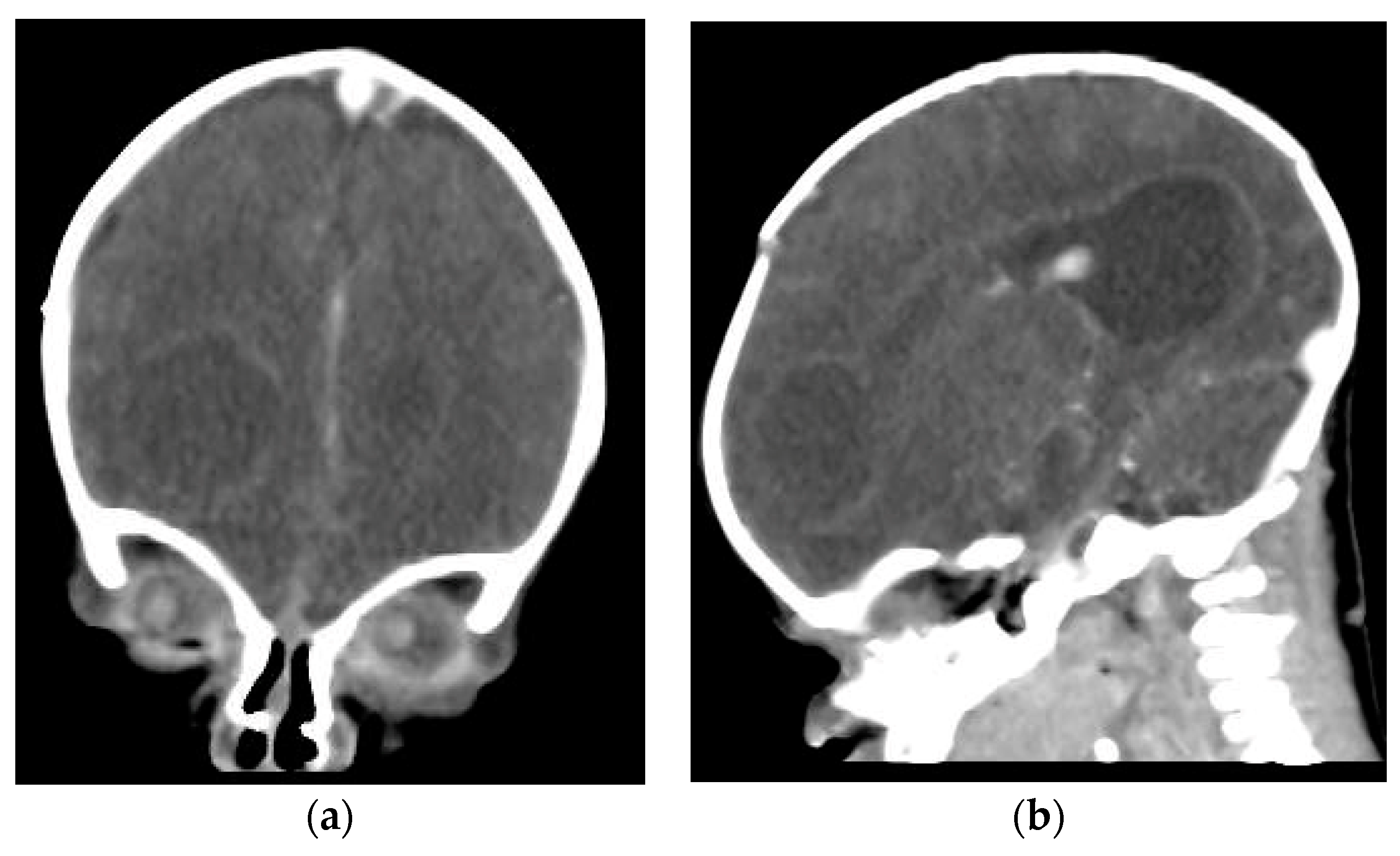 Antibiotics 12 00722 g003 Antibiotics 12 00722 g003