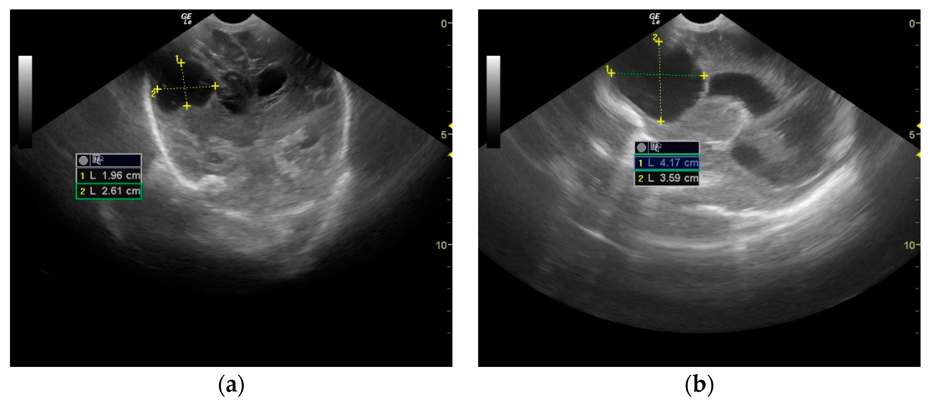 Antibiotics 12 00722 g004 Antibiotics 12 00722 g004