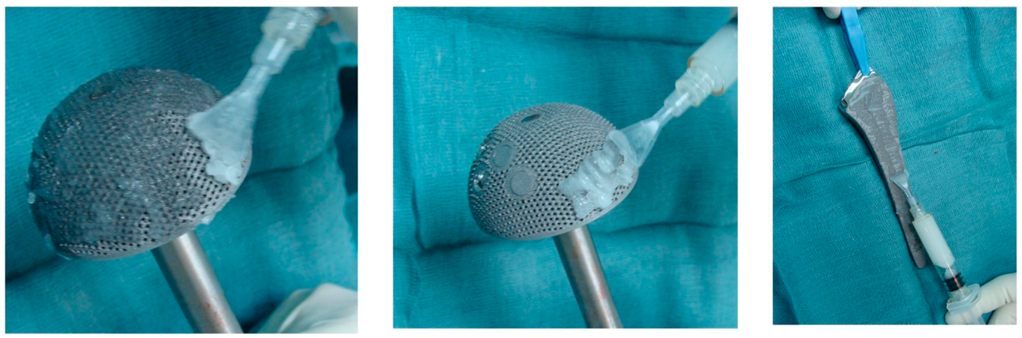 Antibiotics 12 00752 g004 Antibiotics 12 00752 g004