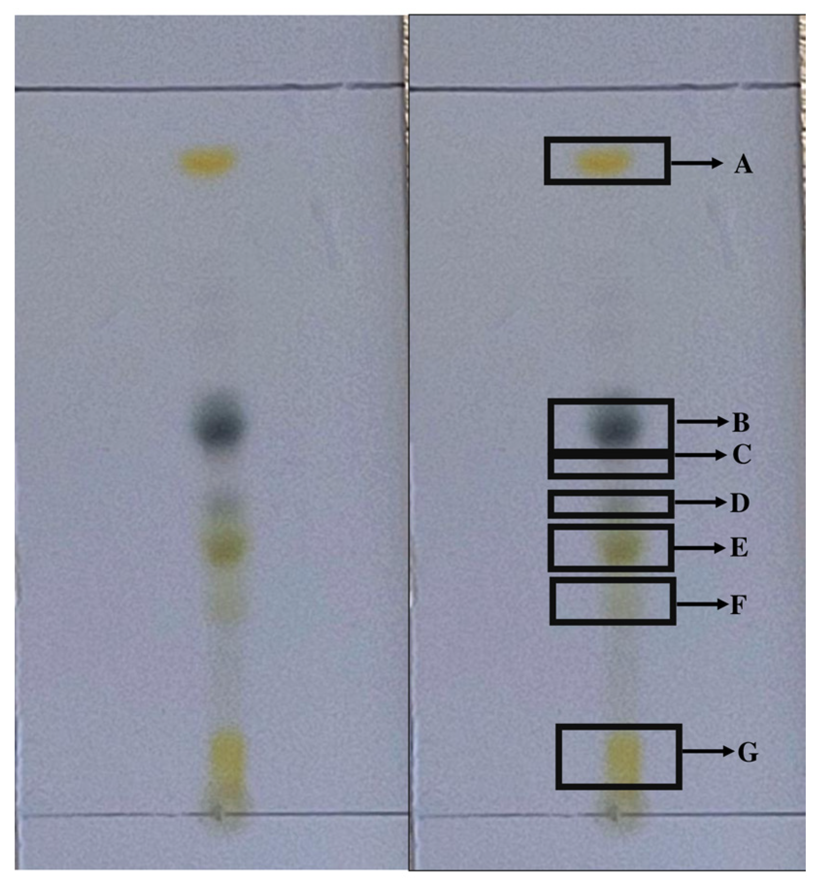 Antibiotics | Free Full-Text | Evaluation of the Anti-Toxoplasma gondii  Efficacy, Cytotoxicity, and GC/MS Profile of Pleopeltis crassinervata  Active Subfractions
